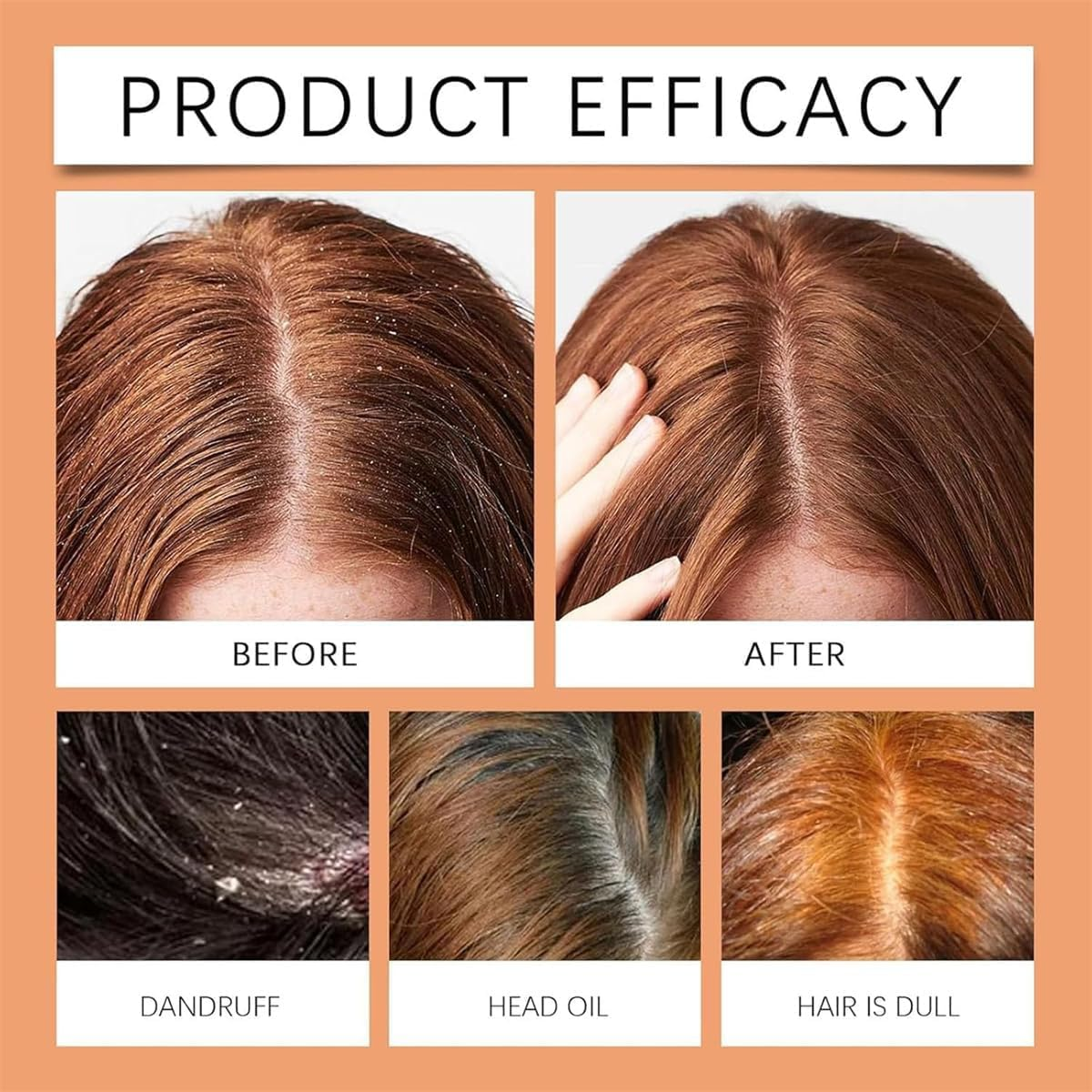 2Pcs Lissima Natural Scalp Scrub,Deep Cleansing & Nourishing Exfoliating,Moisturizing and Comfortable,Relieve Itchy Scalp & Dandruff, Gentle Formula, for All Hair Types image number 4