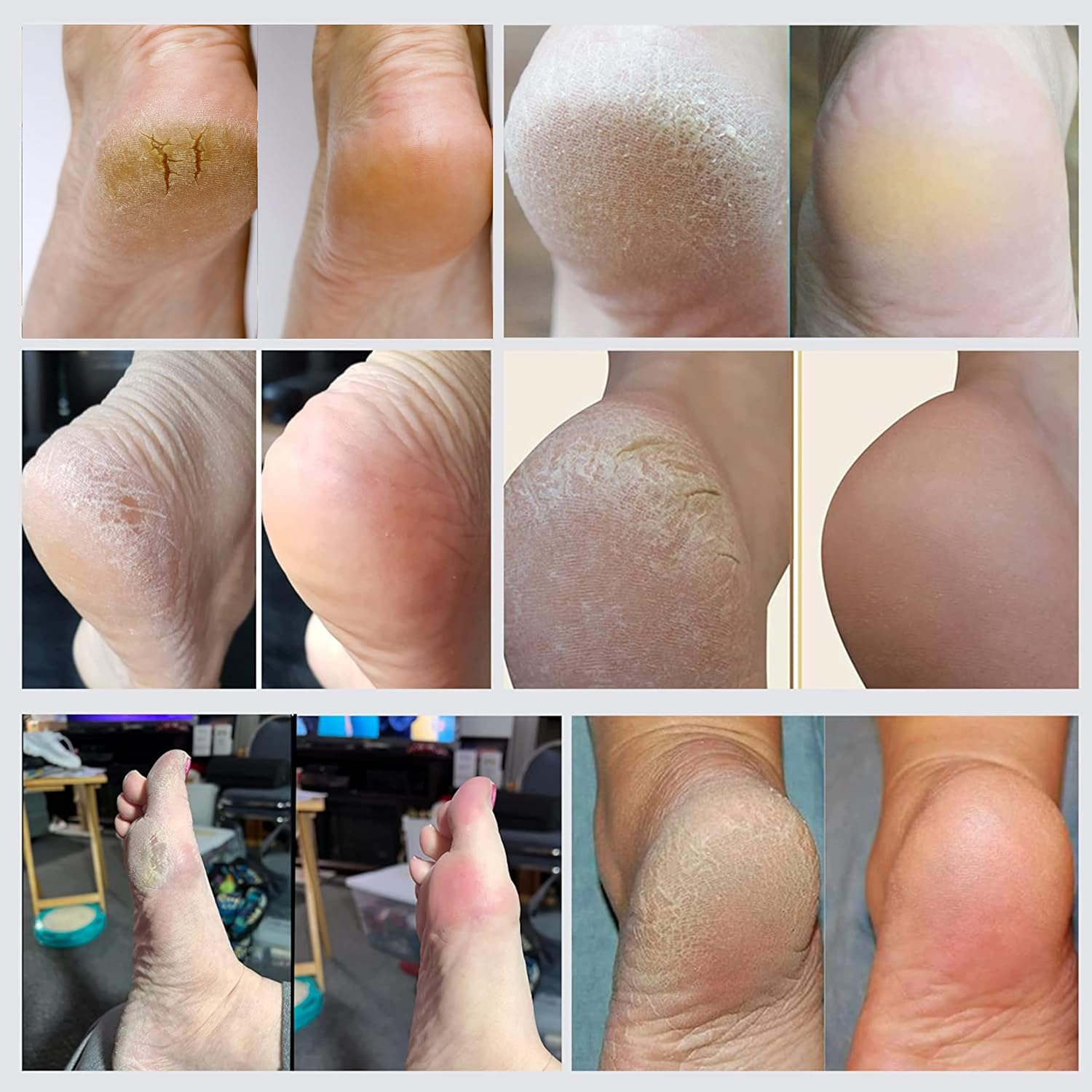 Double Sided Foot File - Made in Germany Feet Scrubber and Feet Softener Callus Remover Spay., Red, 1.0 Count image number 3