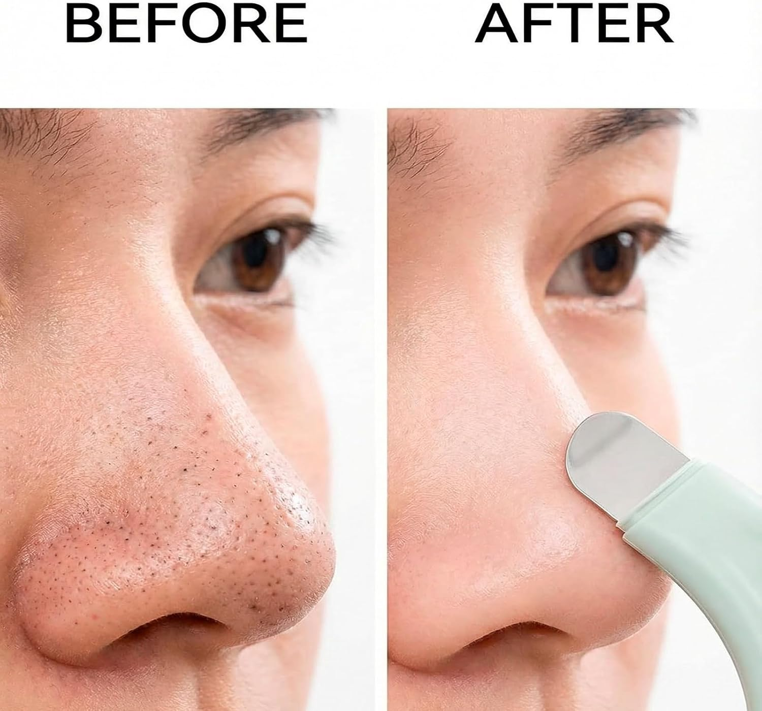 Yxvyxymyxxg 3 Pack Blackhead Remover Tool Silicone Face Scraper for Deep Cleansing Skin Scrubber Face Spatula Nose Blackhead Remover Pore Cleaner Skin Care Tools for Men and Women image number 4