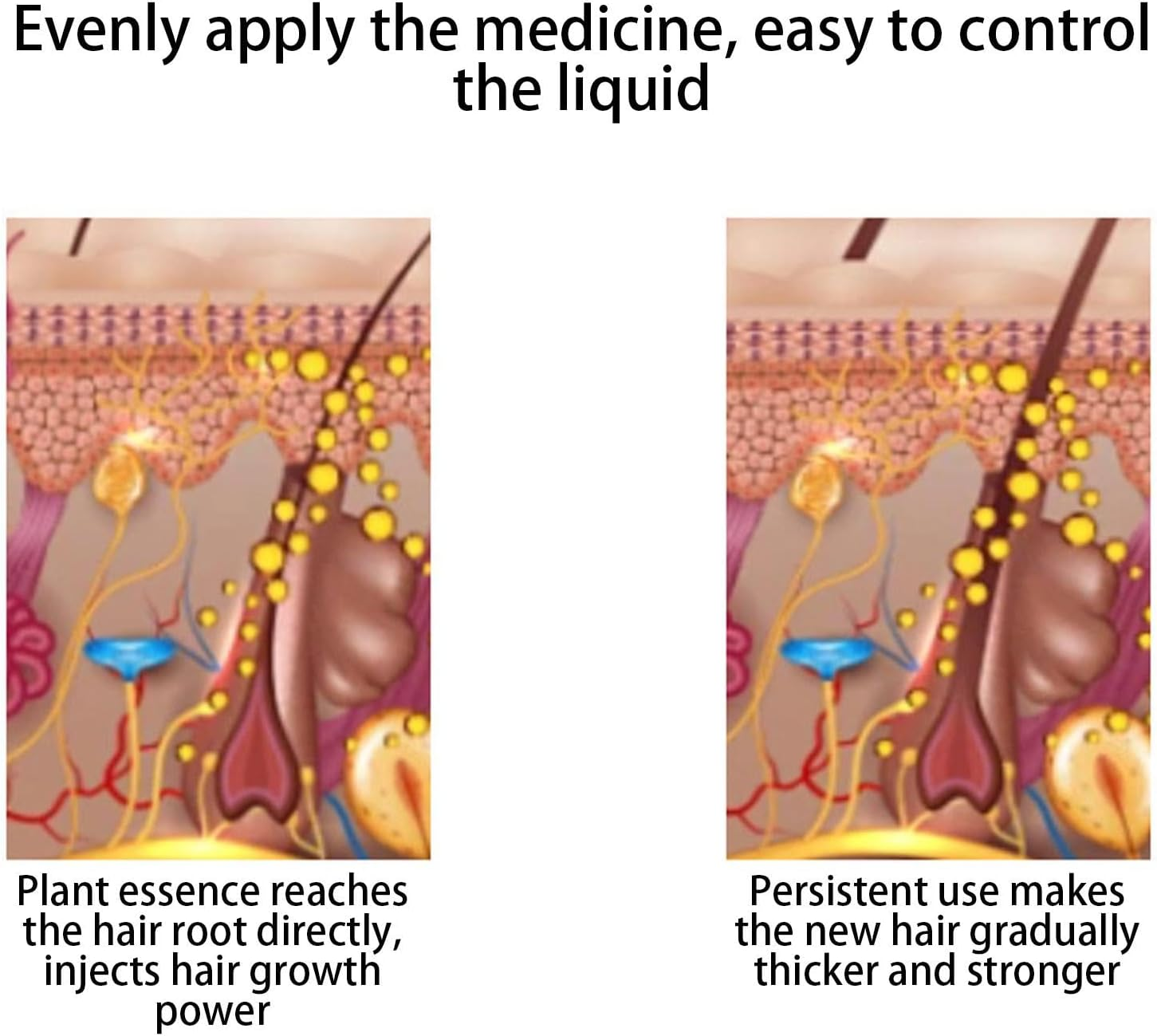 Qikam Oil Applicator for Scalp | Hair Oiling Applicator Combs,Hair Oiler Applicator, Scalp Oil Applicator, Hair Oil Dispenser for Men Women Massaging Scalp image number 1