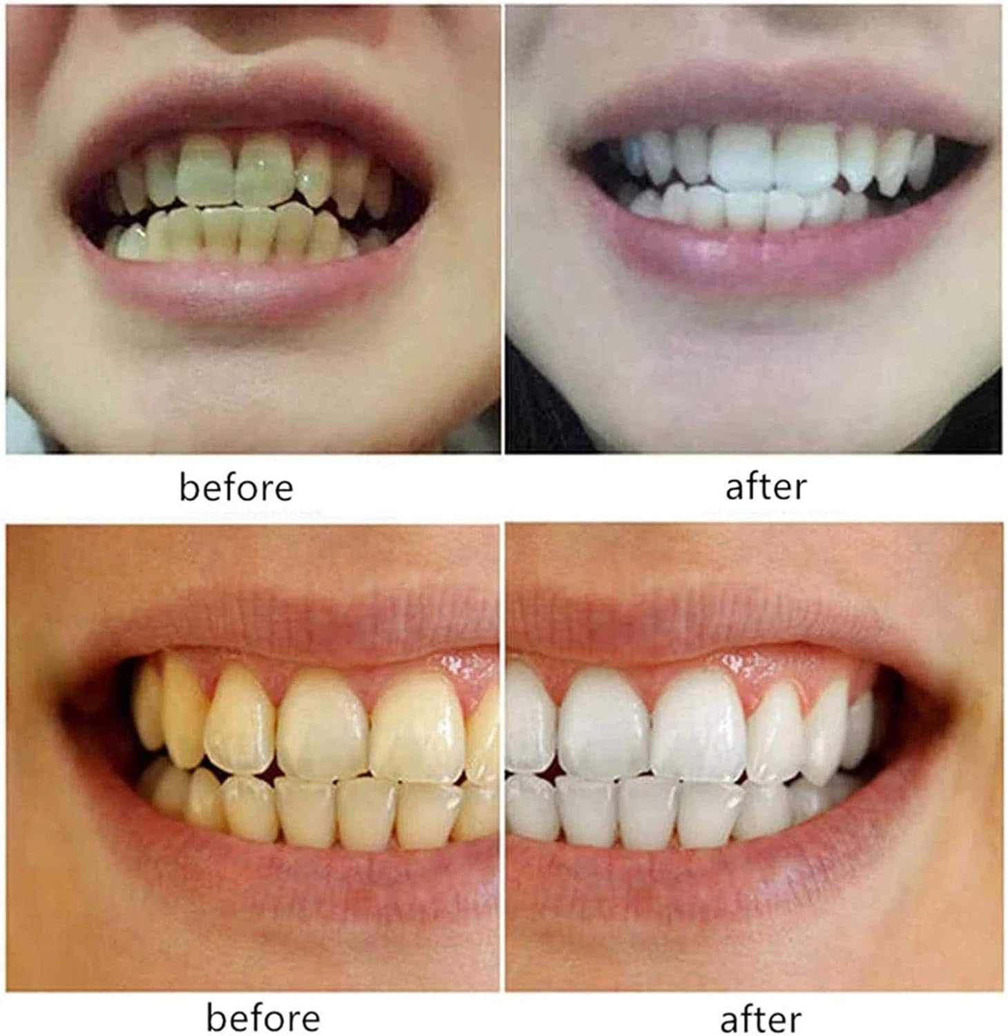 Wiruswin 153-02-02 Elegant MAXAM (SG17J) 153-02-02 Tandem Bar 1.5 in (38 Mm)