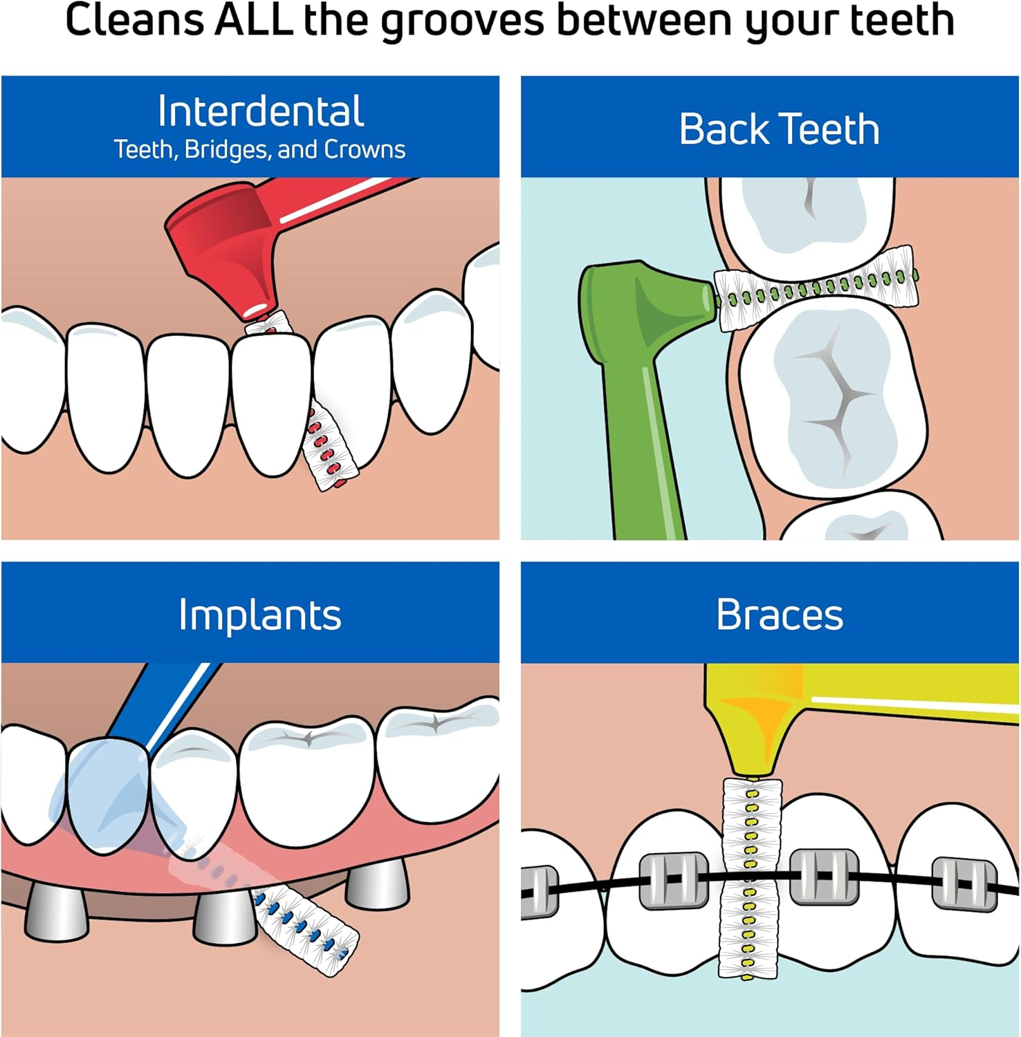 Tepe Interdental Brush Angle, Green, 0.8Mm/Iso 5, 6Pcs, Plaque Remover, Easy and Efficient Cleaning between Teeth, Tooth Floss for Small Gaps image number 6