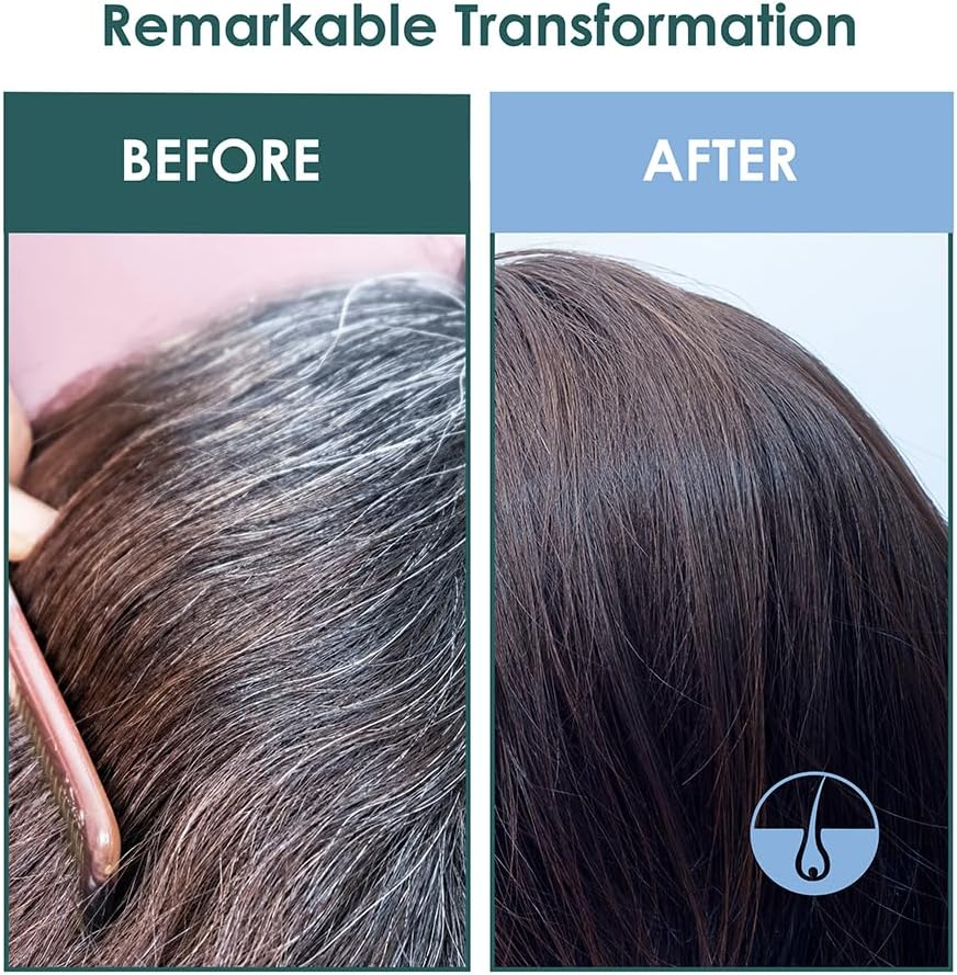 SH-RD Intensive Root Repair Essence (1.69Oz/50Ml) Anti-Aging Exclusively for Scalp, Hair Loss Slowdown, Eliminate Excess DHT Production image number 1