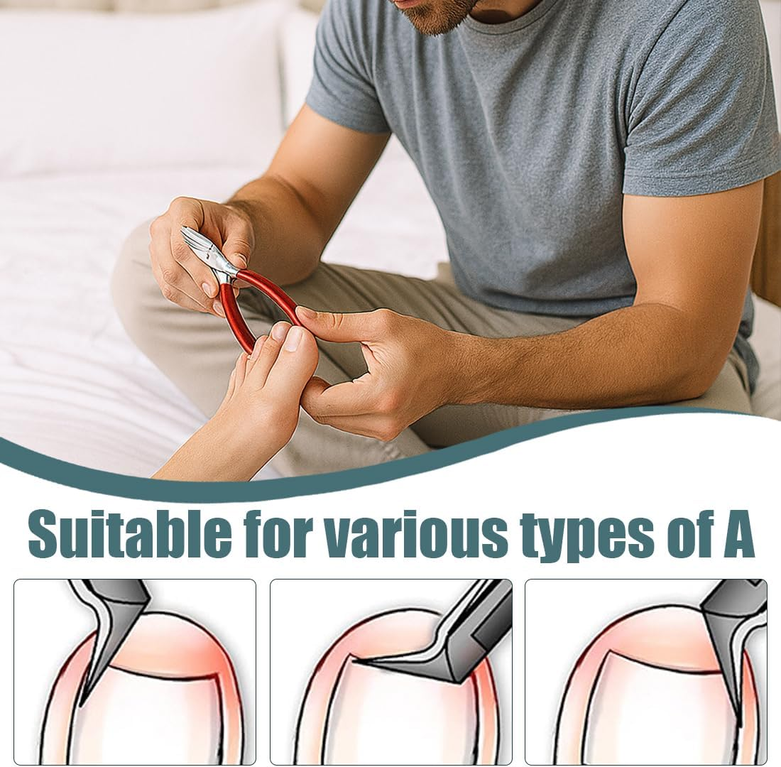 GXGM Professional Toenail Pliers Set, Stainless Steel Toenail Nail Scissors Set Toenails Pedicure Set with Nail Clippers for Thick Ingrown Hard Toenails Paronychia Onychomycosis (Red) image number 1