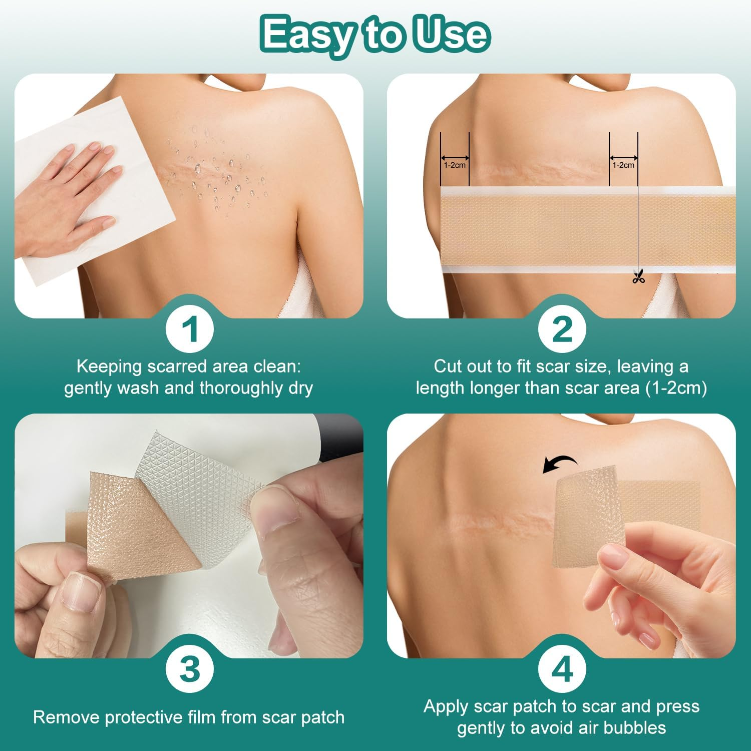 VICHYIE Silicone Scar Tape, Great Adhesion, Skin-Friendly, Reusable, Silicone Scar Sheets for Surgical/Trauma/Keloids/Acne Scars (4 X 150Cm) image number 6