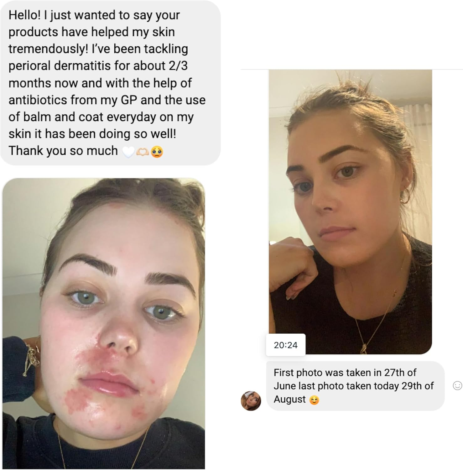 Yours Only, Nourishing Face and Body Moisturiser, 500Ml, Sensitive Skin, Eczema-Prone, All Ages, Fragrance-Free, Dermatologically Tested, Australian Made image number 5