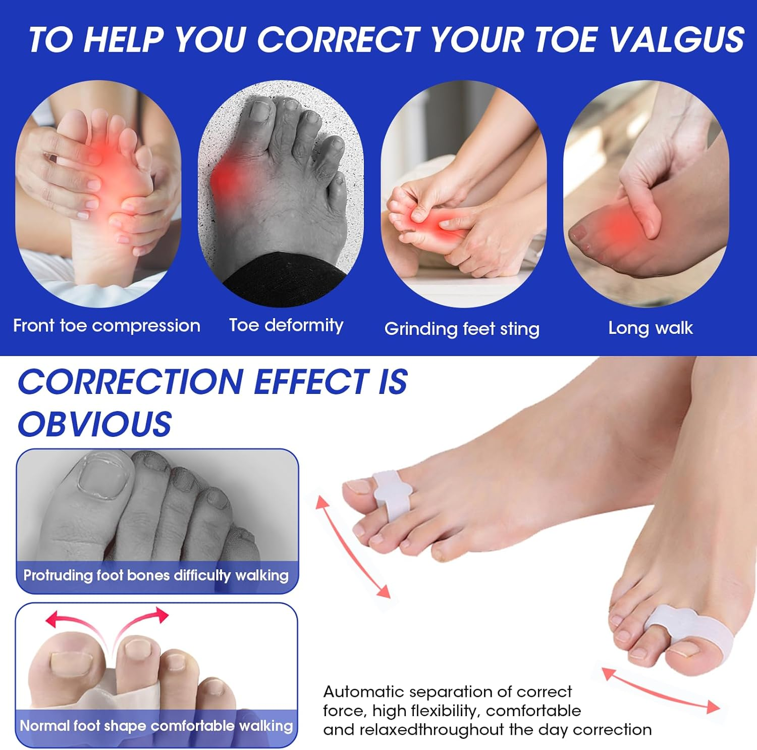 Silicone Gel Toe Separators & Bunion Corrector, 8-Pair Reusable Orthotics for Overlapping Toes, Hammer Toe Relief, Plantar Fasciitis (Men/Women) image number 1