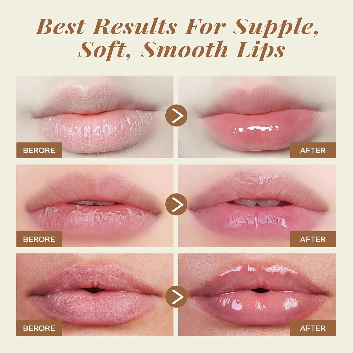 ANAI RUI Lip Scrub & Lip Mask Set with Shea Butter, Lip Scrubber Exfoliator Enriched with Vitamin E, Sugar Scrub for Dry Lips, Hydrating Lip Mask for Overnight Use, Gift Set for Women and Girls (Coconut)