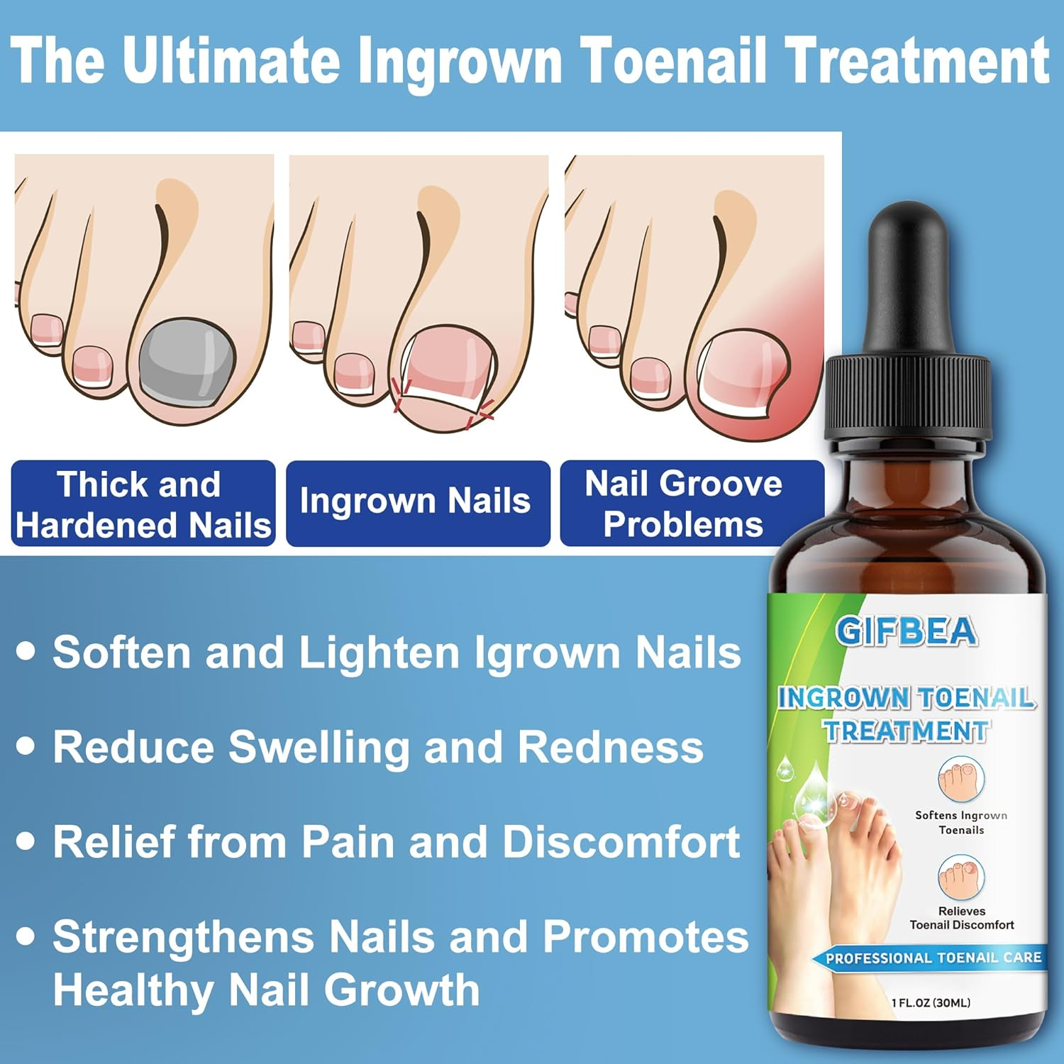 Ingrown Toenail Treatment W/Ingrown Toenail Drops Reliever & Softener,Double Sided Pedicure Nail Lifter Tool for Easy Trimming Care Thick Nail & Ingrown Toe Nail,Toenail Cleaner Kit for Men Women image number 1