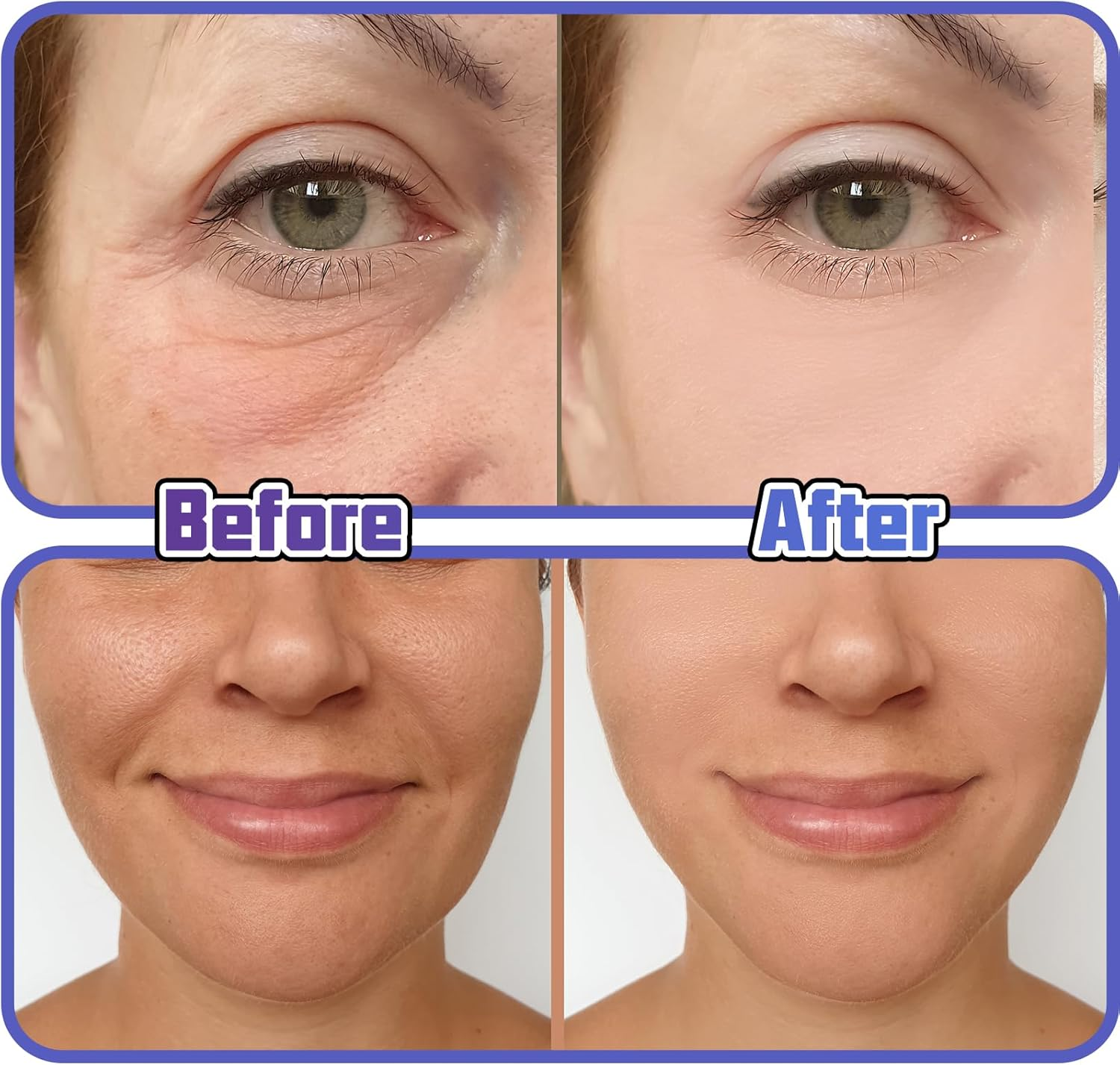 HAIOLORPRO 240PCS Face Lift Tape, Neck Tape Lifting Invisible, Makeup Facelift Tapes for Lifting Sagging Skin, Wrinkles, Jowls, Eyes, Double Chin image number 4