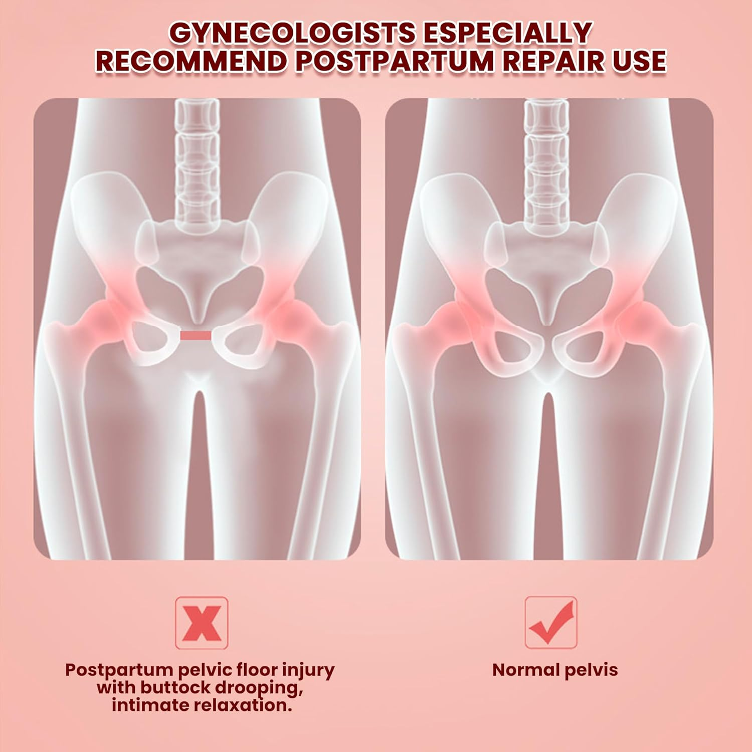 TKTCO Thigh Trainer, Pelvic Floor Muscle Trainer, Inner Thigh Exercise Workout Equipment for Home Gym, Pelvic Floor Strengthening Women image number 2