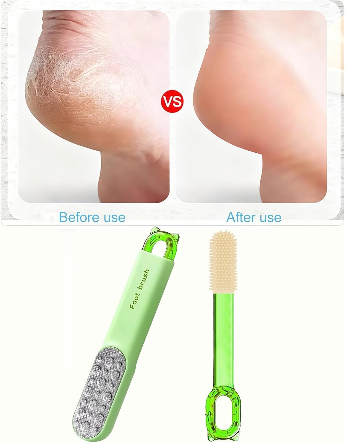 3-In-1 Pedicure Scrubber Tool - Foot Pumice Stone,Stainless Steel Dual-Sided Foot File & Callus Remover, Durable Easy-To-Clean Rasp for Hard Dead Skin, Corn Removal & Soft Feet,Dry & Wet Use (Green,5 PCS) image number 2