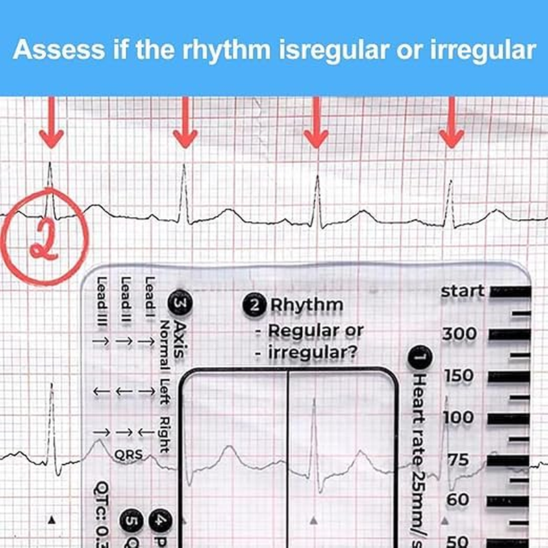 ECG 7Step Ruler,Ecg Ruler Plastic Ruler Measuring Tool,Ecg 7Step Ruler for ECG/EKG Interpretation,Transparent EKG Calipers 7Step Ruler,Follow a 7Step Plan ID Sized for Nurse or One in Healthcare (2)