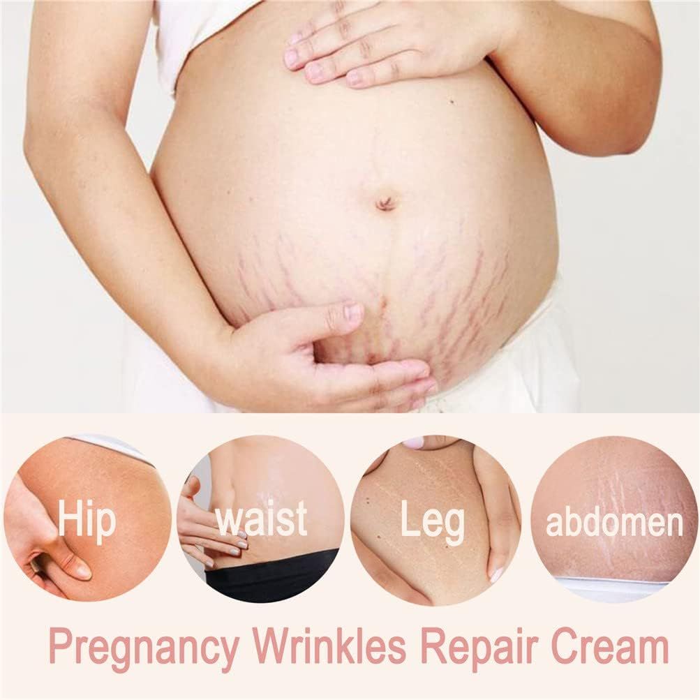 Organic Flawless Firming Cream Stretch Marks Fading Cream Stretch Marks Reversal Cream Stretch Marks Remover Cream Skin Care Treatment Cream for Stretch Mark Removal Maternity Slackline image number 5