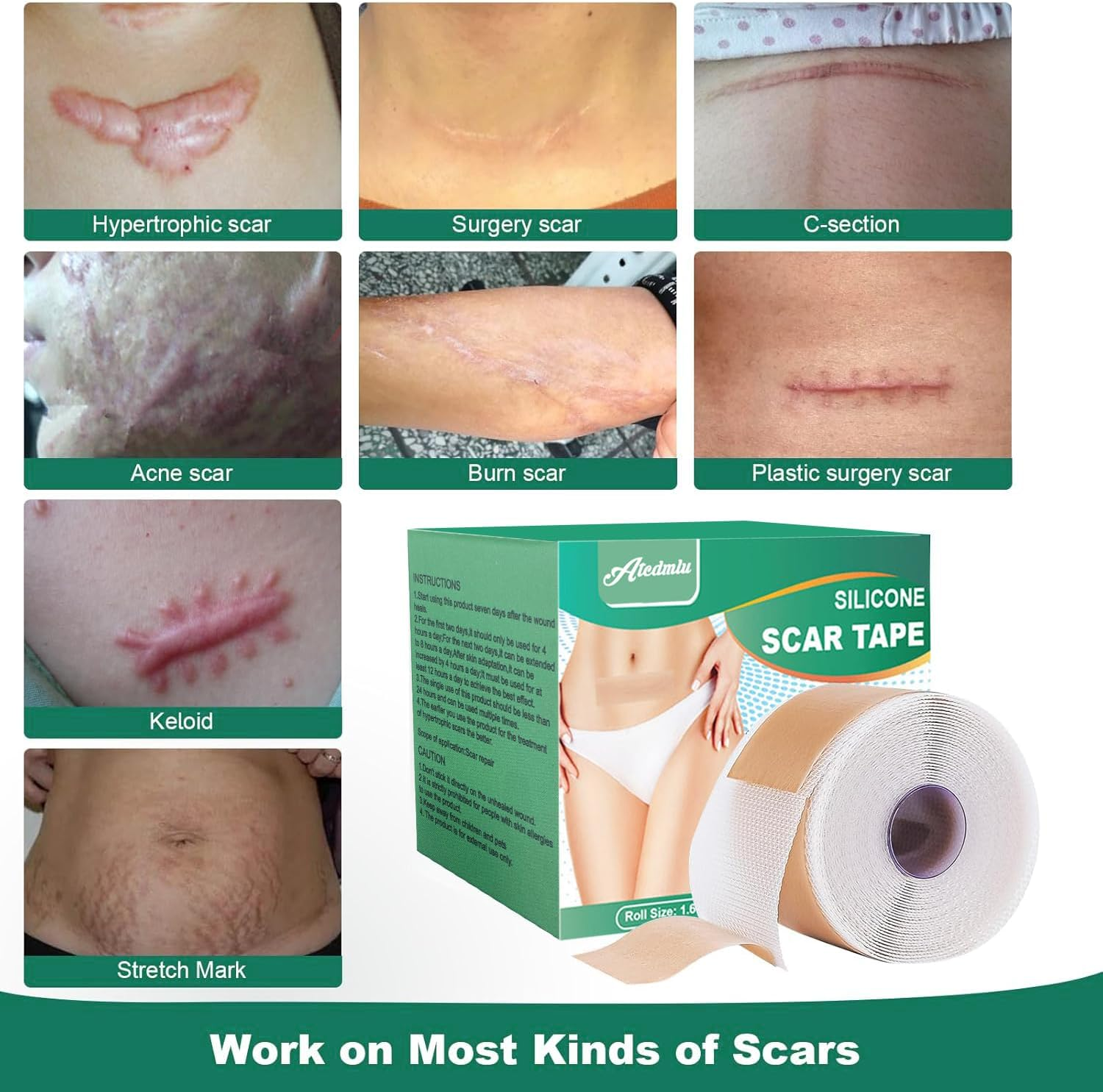 Silicone Scar Sheets & Tape for Surgical Scars, C-Section, Tummy Tuck | Scar Removal Strips to Repair, Fade & Remove Keloid Bumps | 1.5M Roll (4X150Cm) | Hypoallergenic, Reusable Medical Grade image number 1