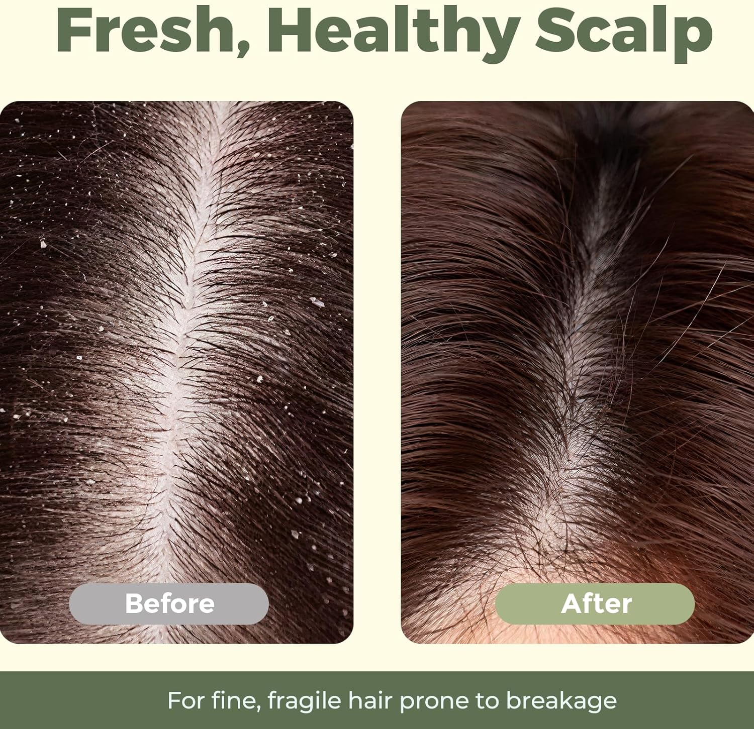 SAISZE Tea Tree and Mint Shampoo and Conditioner Bar Set, anti Dandruff Shampoo Bar for Itchy and Dry Scalp, Infused with Biotin image number 5