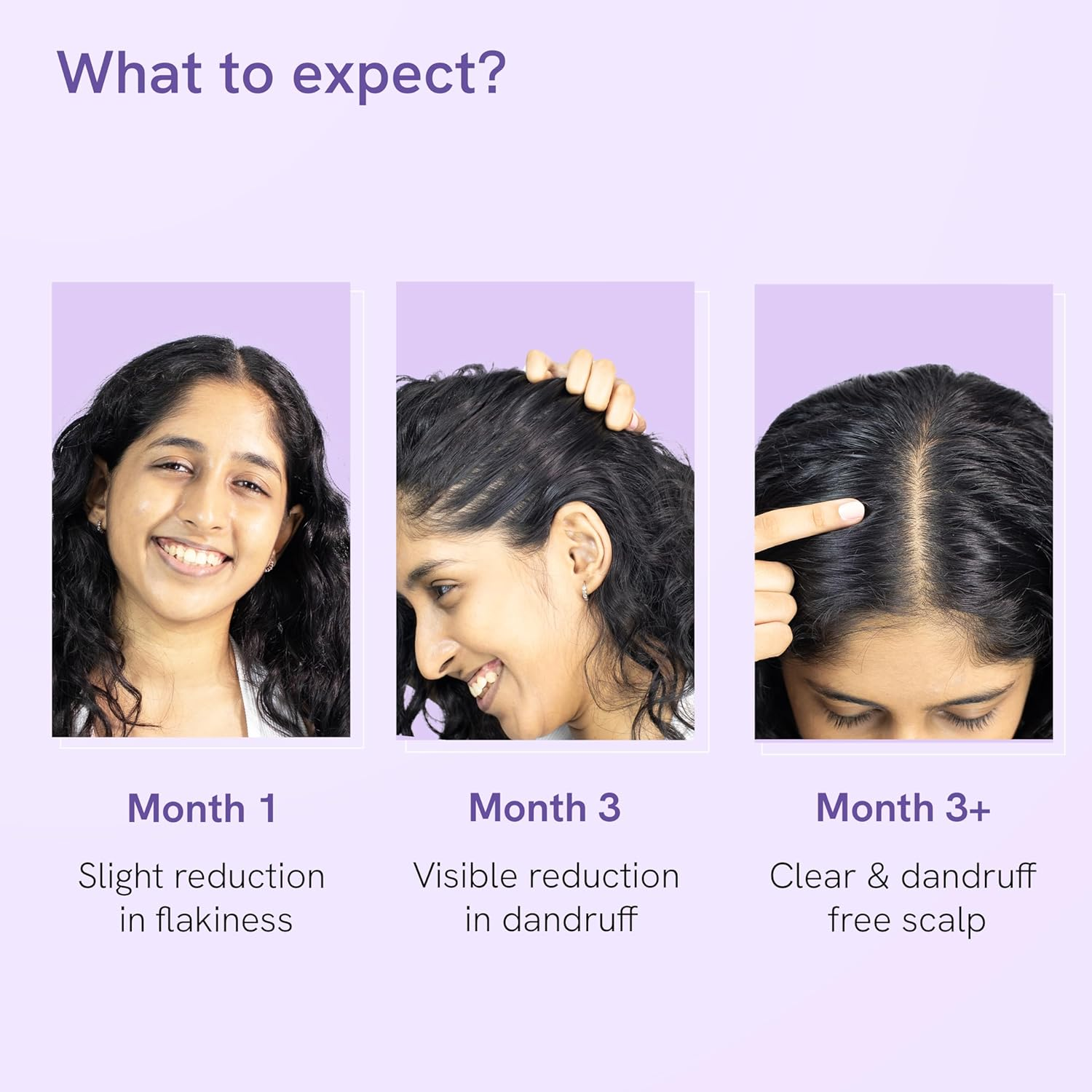 Be Bodywise anti Dandruff Scalp Serum 50Ml | Fights Dandruff, Reduces Flaky & Itchy Scalp | with Ichthyol Pale, Zinc Pyrithione, & Tea Tree Oil | Paraben & Sulphate Free image number 1