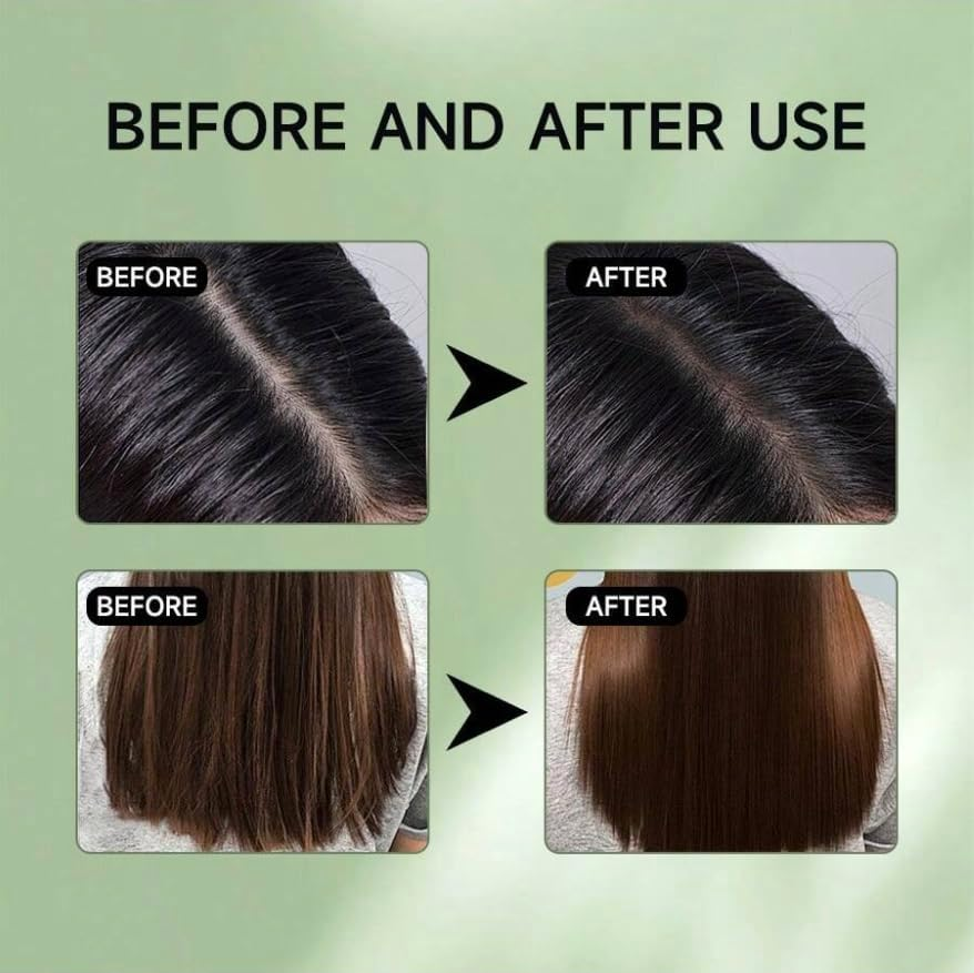 Rosemary Castor Scalp and Hair Strengthening Oil with Biotin, 60Ml image number 2