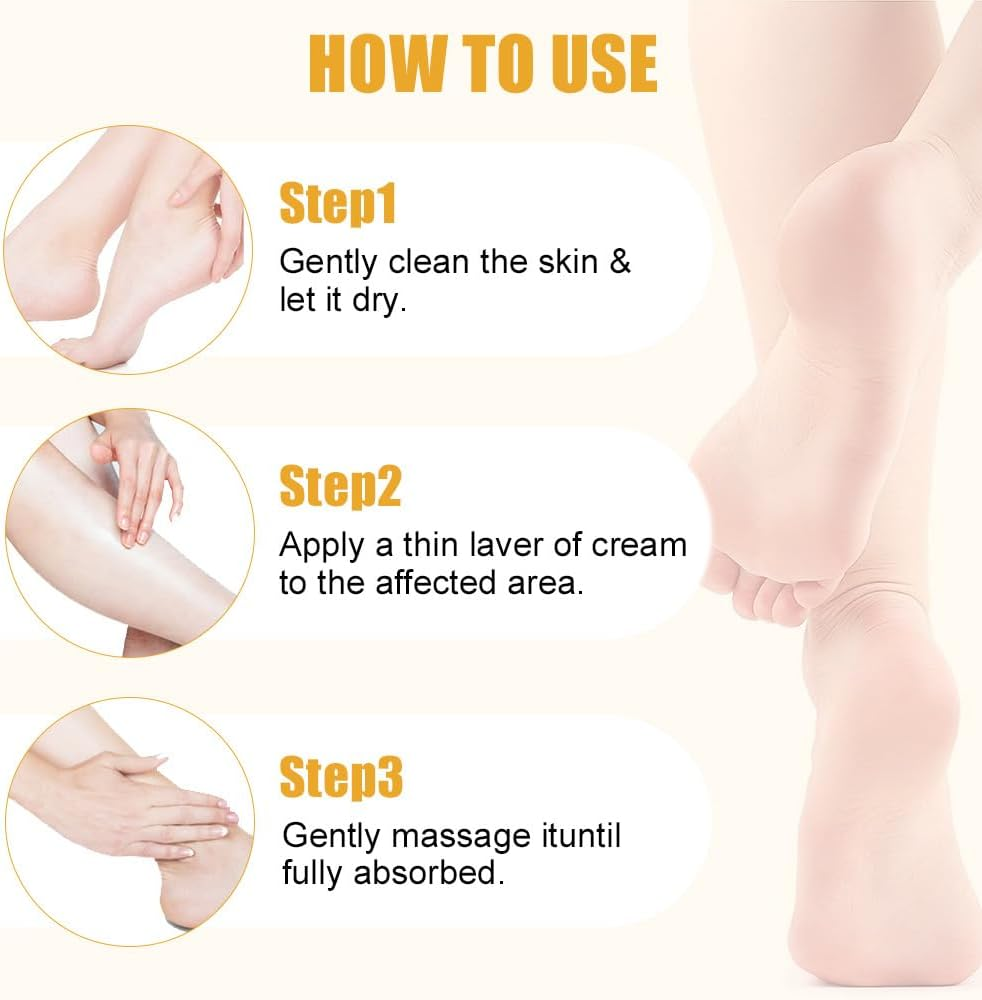 Urea Cream 60 Percent for Feet with 2% Salicylic Acid - Heel Balm,Foot Cream for Dry Cracked Feet,Cracked Heel Repair,Exfoliate Foot Skin,40G (2) image number 5