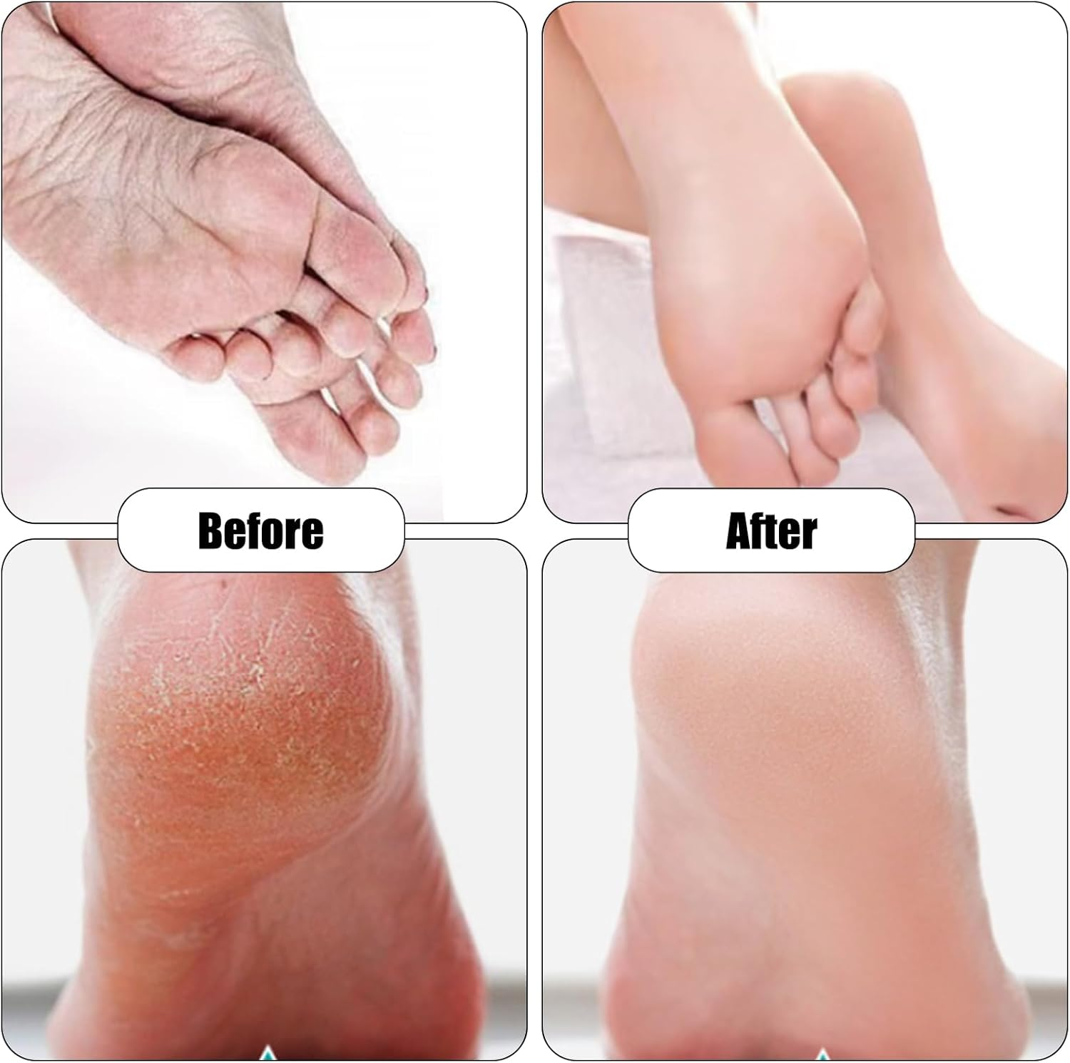 9 Pack Replacement Rollers Extra Coarse Rollers for Feet Roller Refill Heads Compatible with Finishing Touch Flawless Pedi Electric Tool File image number 4