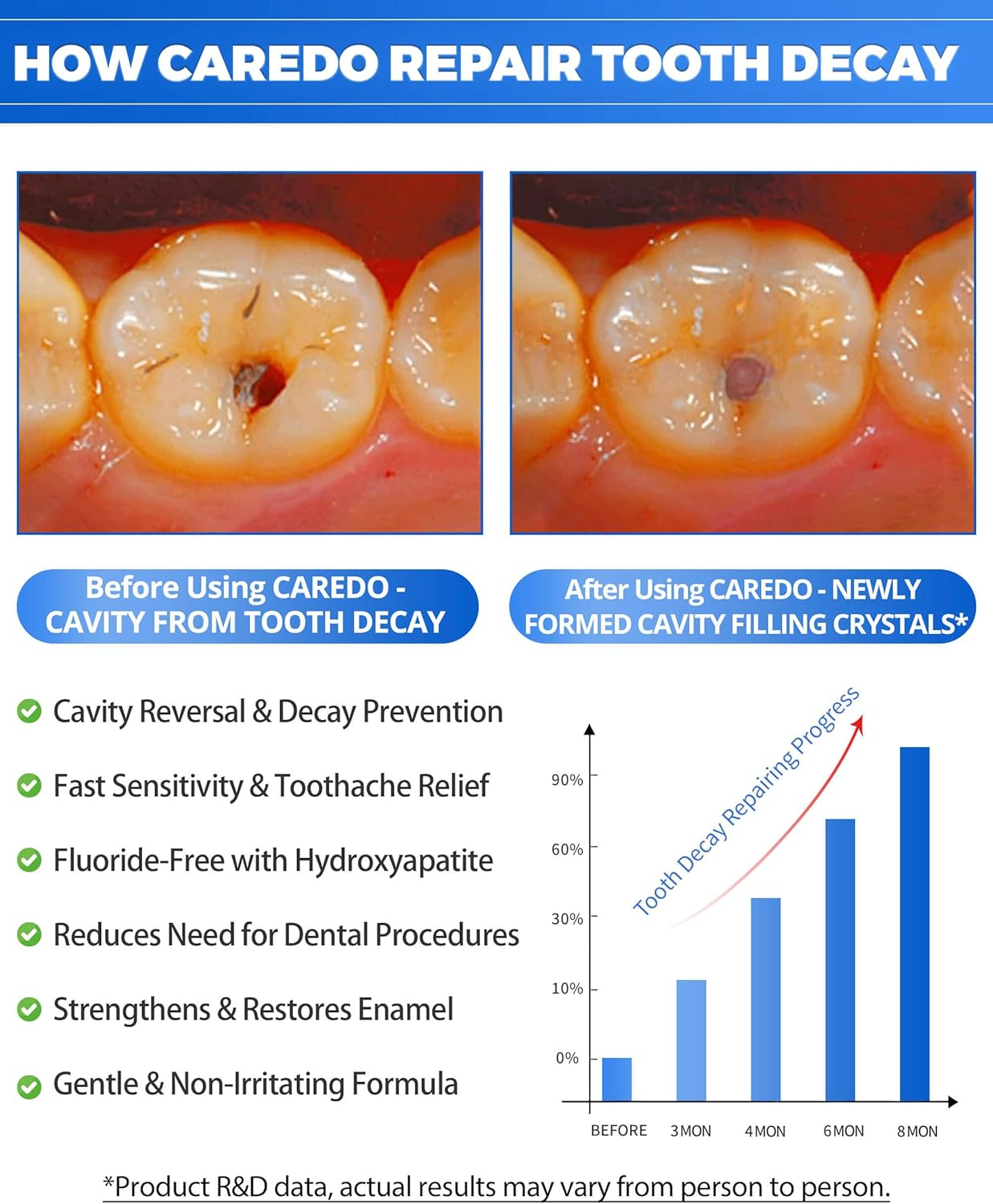 Cavity Reversal Hydroxyapatite Toothpaste for Adults, Home Cavity Repair Fluoride Free, Reverse Cavities for Tooth Decay Repair, Remineralizing Sensitive Toothpaste 3.52 OZ image number 4