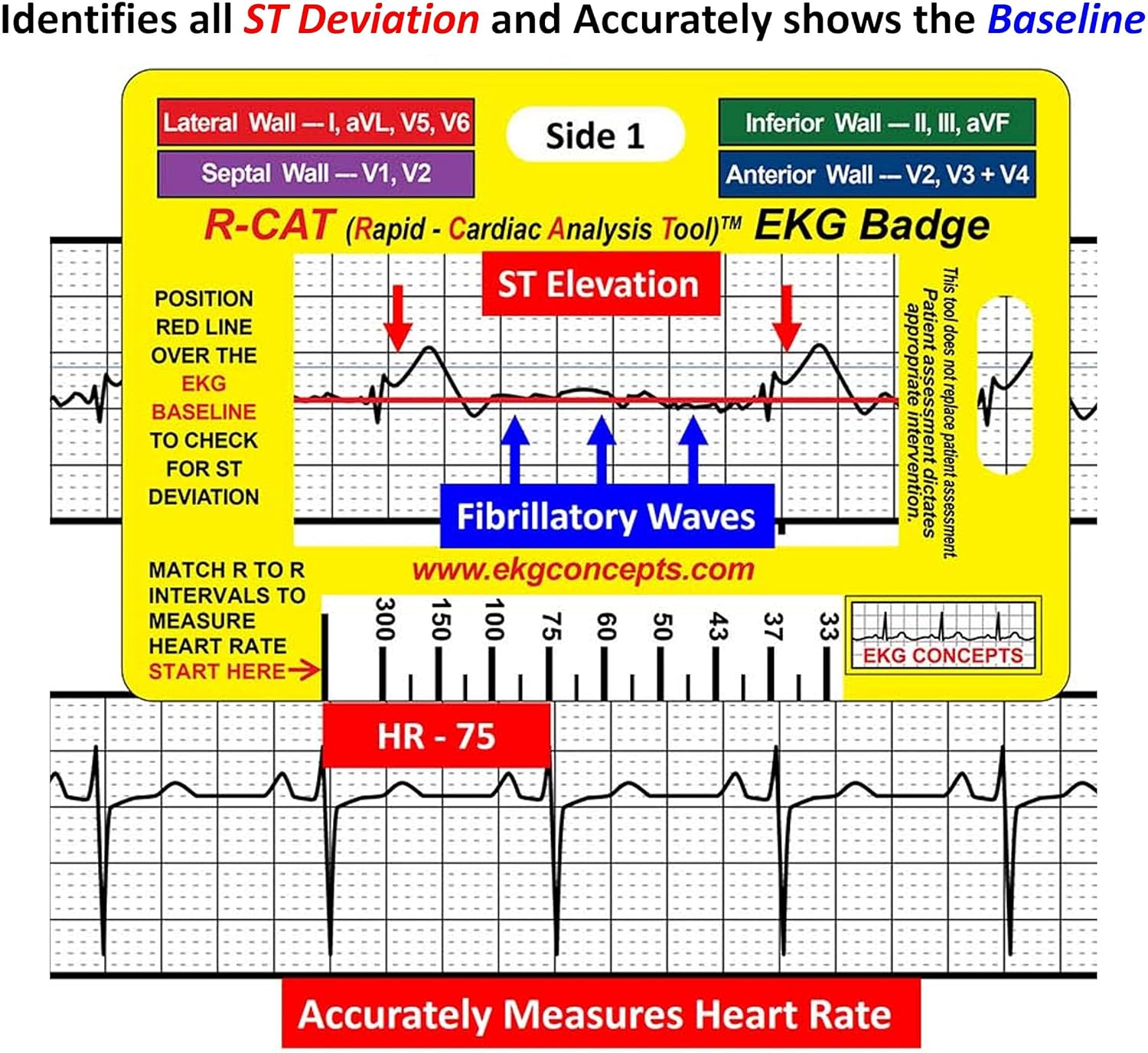 R-CAT EKG Badge image number 1