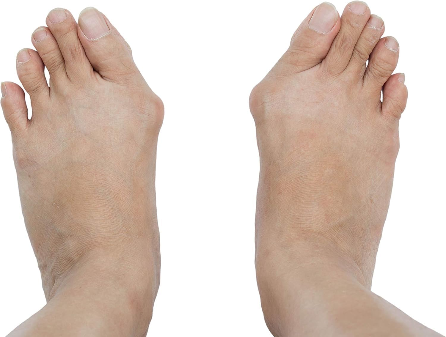 Silicone Thumb Outward Separators Foot Bone Thumb Separators anti Wear Toe Outward Separators image number 1