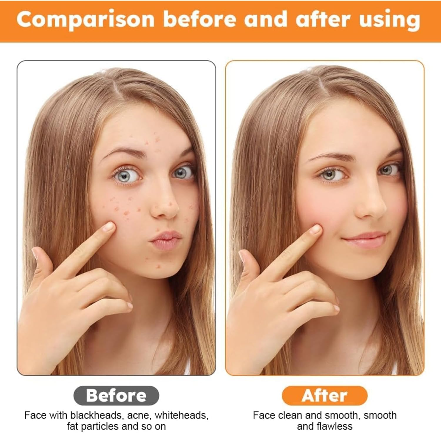 RODISHOMM 15-Piece Blackhead Remover Set - Pimple & Comedone Extractor, Acne & Whitehead Removal Tools, Premium Stainless Steel, Includes Silver Metal Case