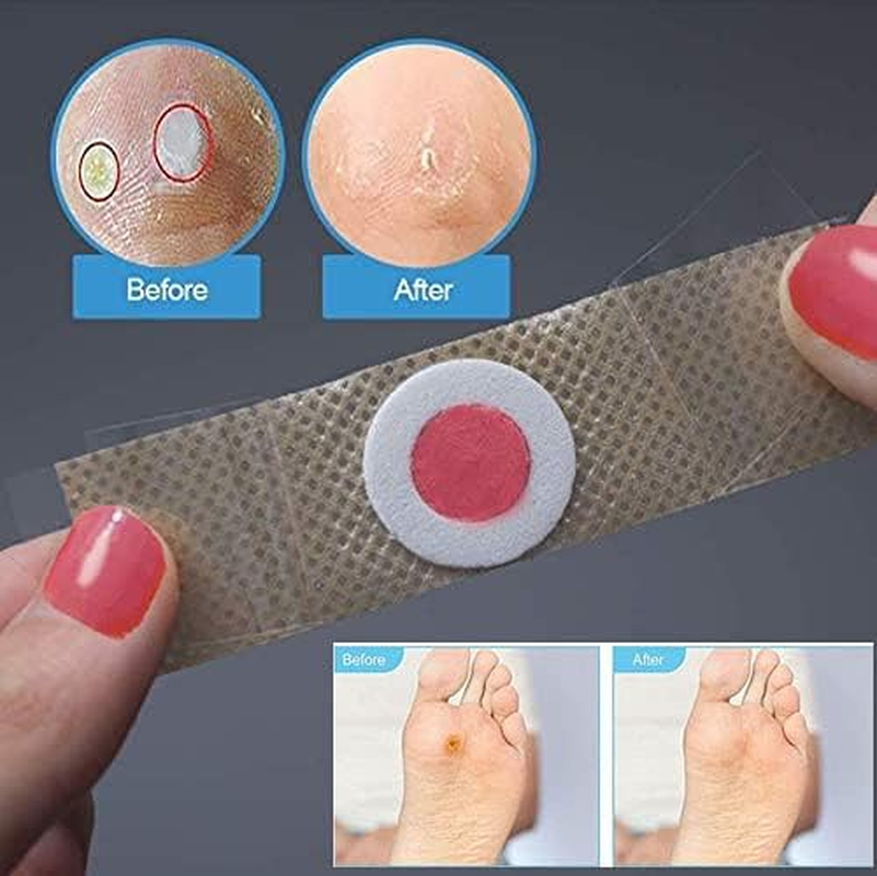 30 Pieces Corn Removers for Feet, Corn Removers for Toe, Foot Corn-Toe Corn-Callus Removal, Corn Remover Feet, Foot Corn Removers, Toes Corn Removal image number 6