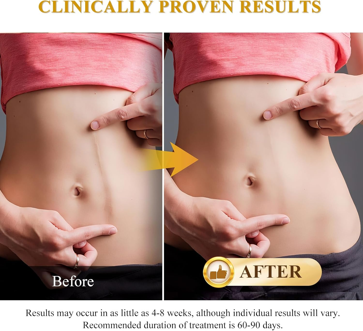 Silicone Scar Cream Scar Gel, Advanced Scar Cream for Surgical Scars, C-Section, Injury, Stretch Marks, Acne, Burns, Keloids, Old & New Scars, 1.85 Oz (55G) image number 3