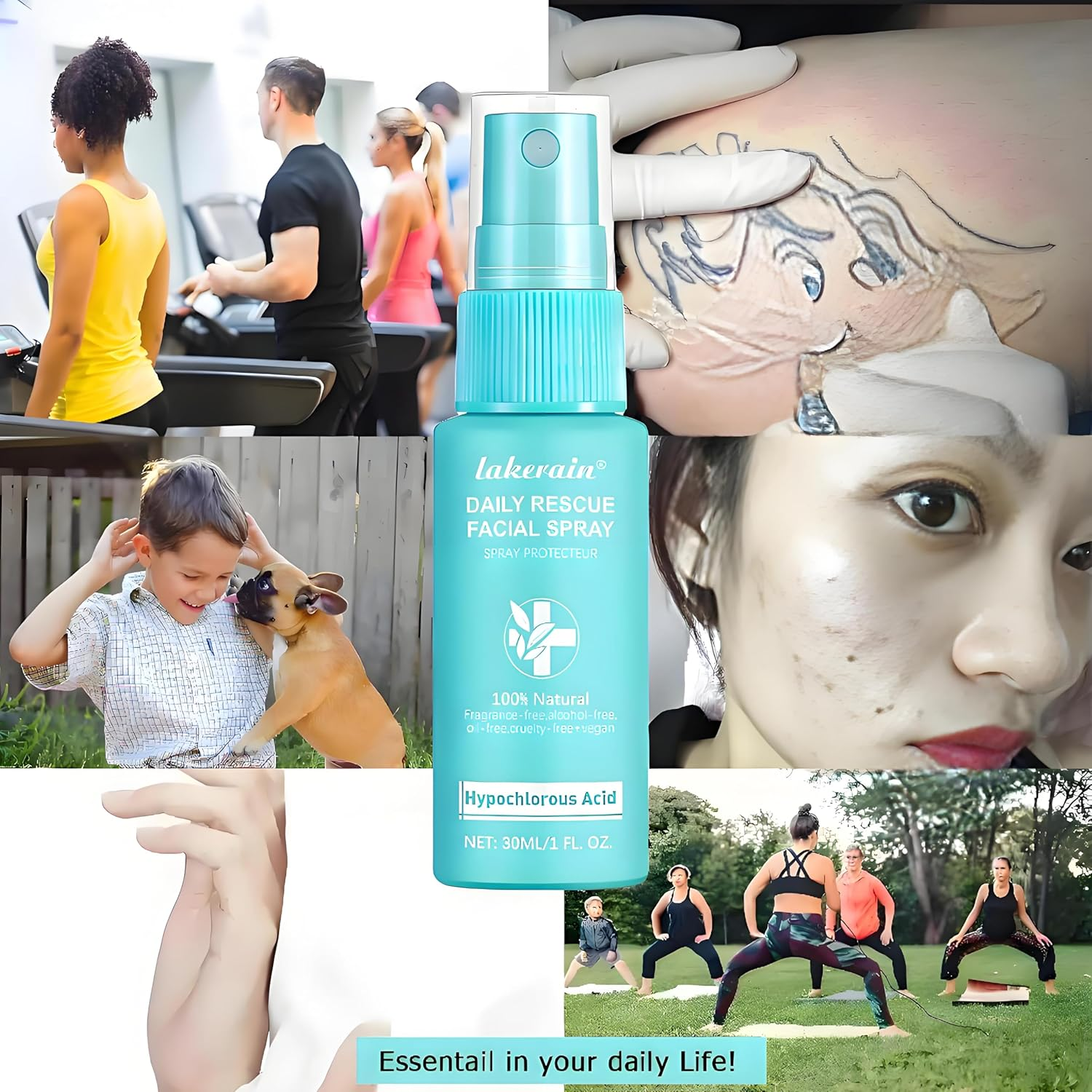 Hypochlorous Acid Face and Skin Spray,30Ml Soothing Facial Spray Face Toner, Hypochlorous Acid Spray for Red and Swollen Skin, Broken Skin Calming Emulsion for Sensitive Skin image number 1