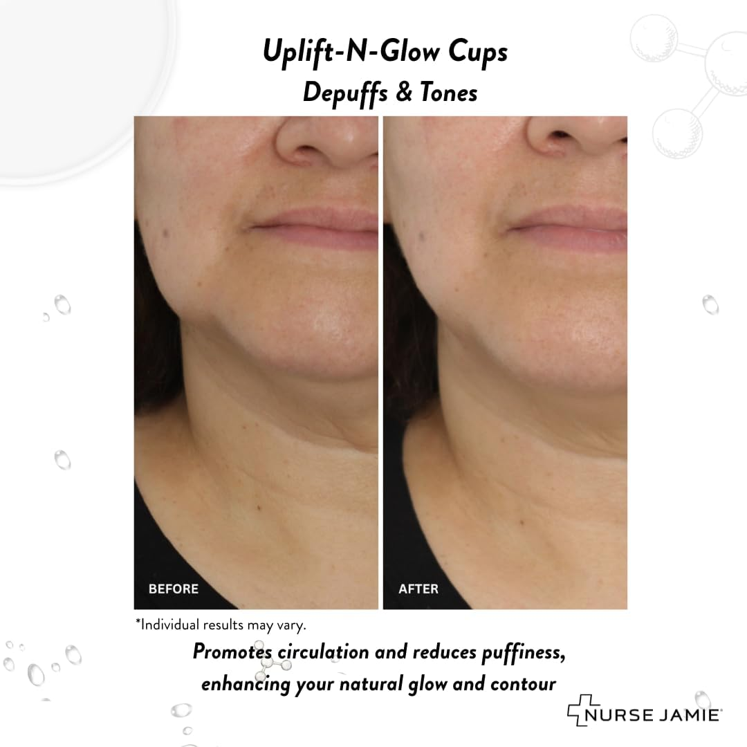 Nurse Jamie Uplift-N-Glow Facial Cupping Tool &ndash; Silicone & Glass Cups for Facial Drainage, Product Absorption & Skin Revitalization image number 3