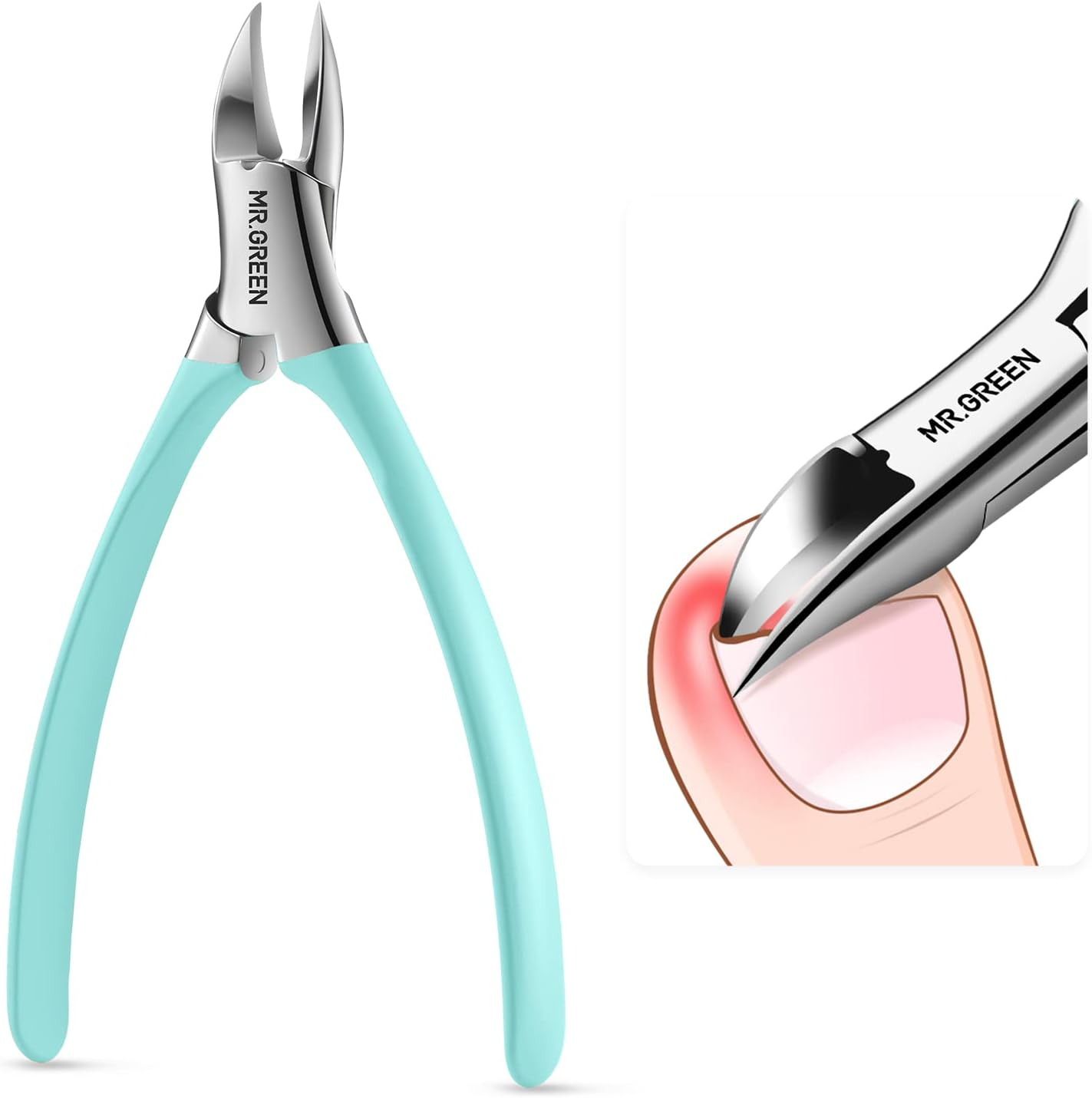 MR.GREEN Toenail Clippers Stainless Steel Ingrown Nail Cutter Thick and Hard Nails Pedicure Manicure Tools (Orange+Nail Remover)