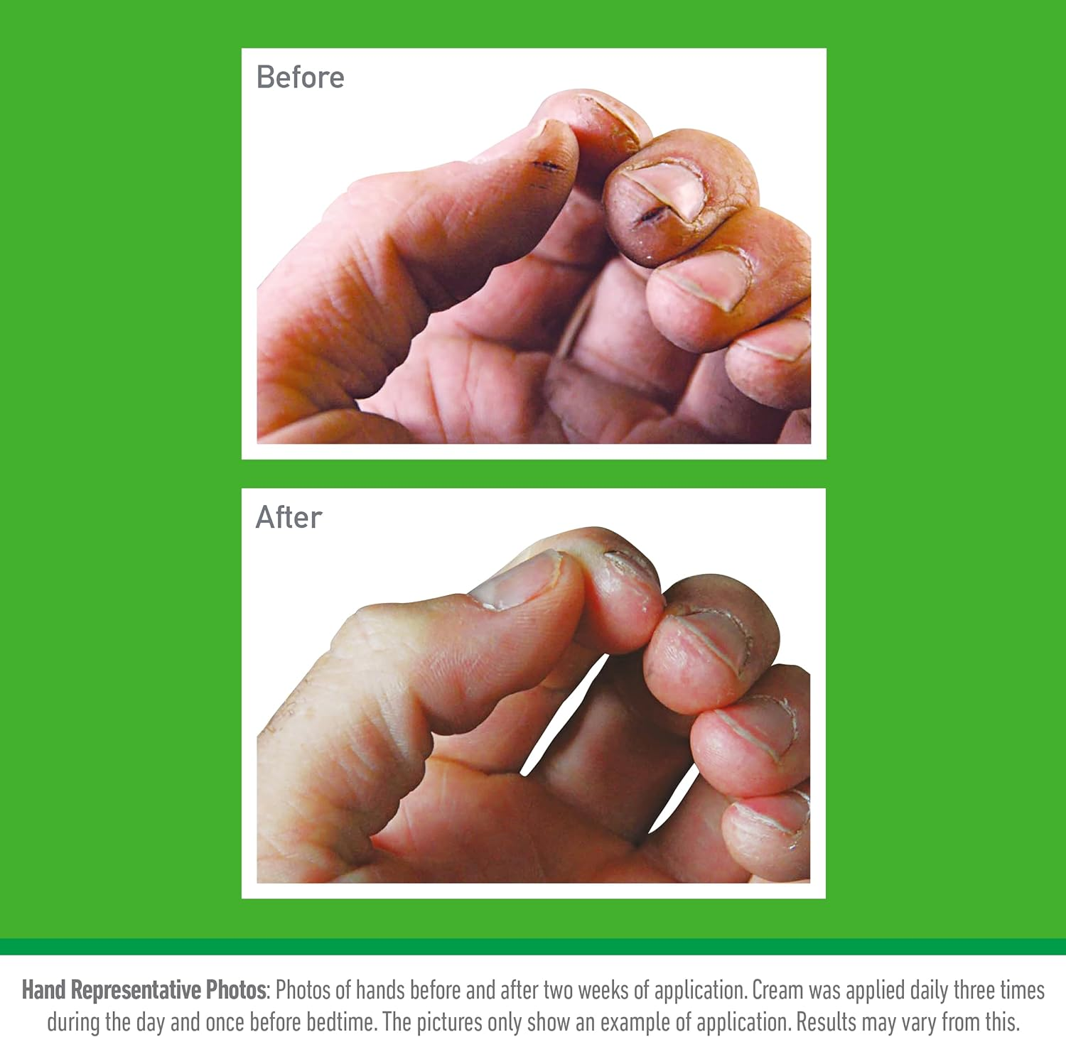 O'Keeffe'S Working Hands, 80Ml Tubes (5 Pack) - Hand Cream for Extremely Dry, Cracked Hands | Instantly Boosts Moisture Levels, Creates a Protective Layer & Prevents Moisture Loss image number 4