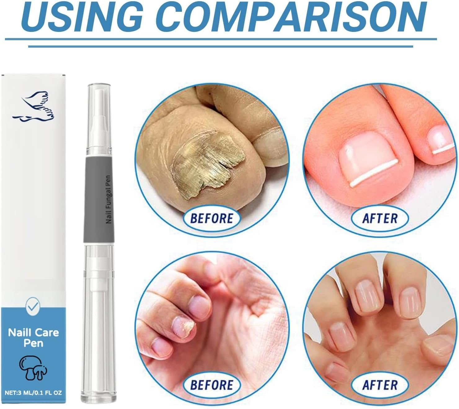 Antifungal Nail Pen for Toenails and Fingernails, Extra Strength Fungus Treatment & Repair Serum with Natural Ingredients, Nail Strengthener and Growth Support (2 PCS) image number 4