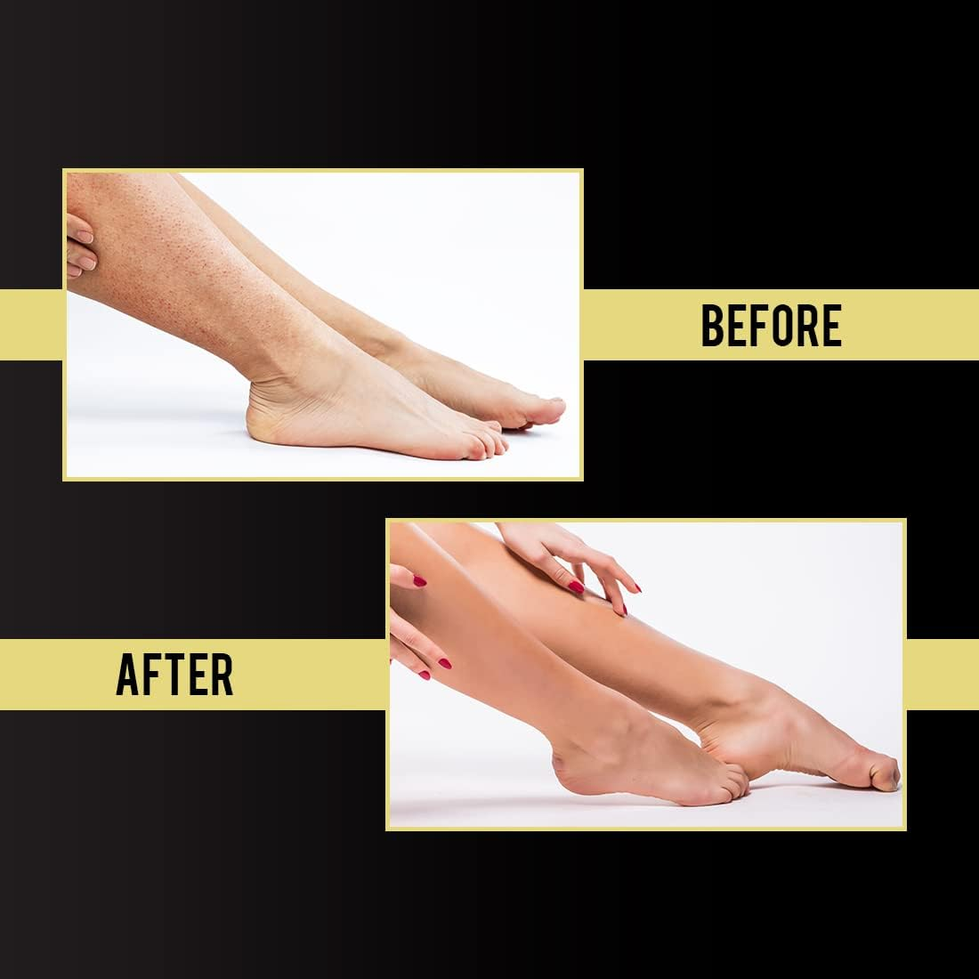 NEUD after Hair Removal Lotion for Skin Care in Men & Women - 1 Pack (100 Gm) image number 4