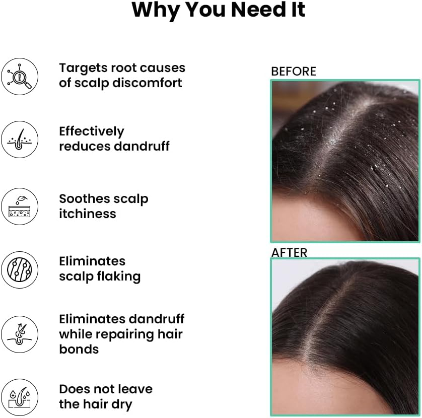 Thriveco Scalp Clear Shampoo for Dandruff Control | Daily Use Shampoo with Zenscalpin&trade;, Hyaplex&trade;, Salicylic Acid | for Dandruff, Flaky & Itchy Scalp | for Men & Women | 250Ml (250 Ml) image number 5