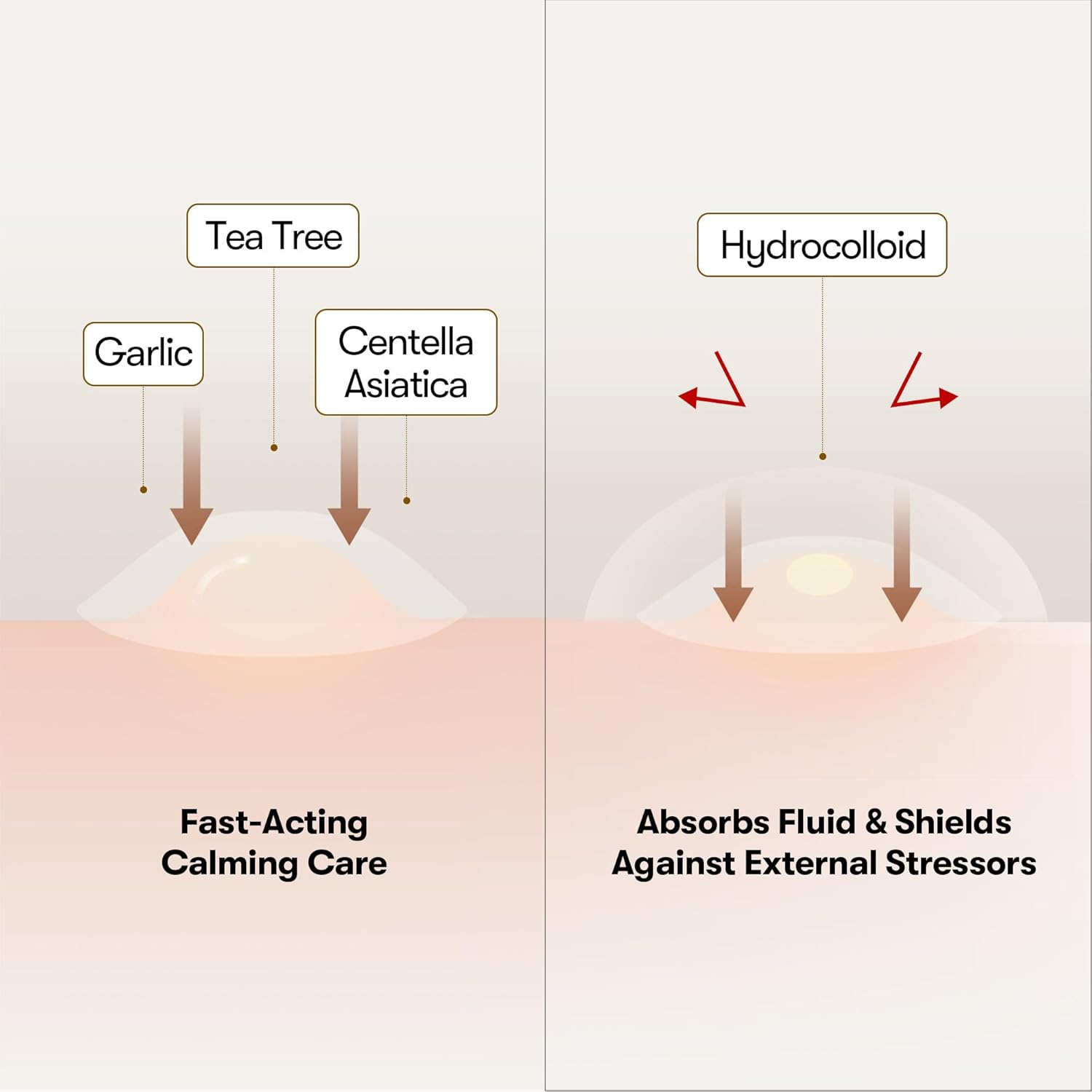 VT COSMETICS Garlic AC Reedle Shot Spot Patch (48 Patches)