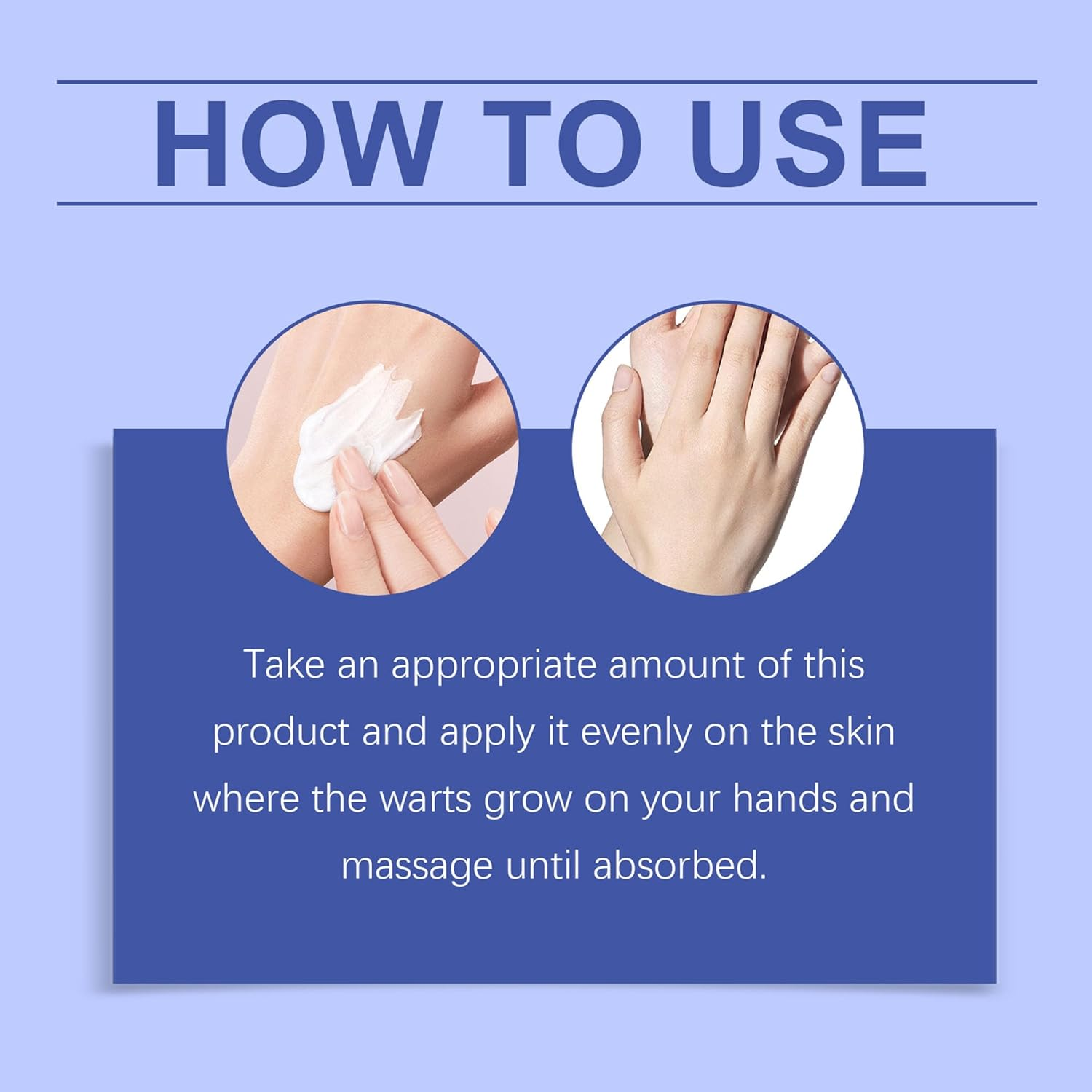 Wart Remover Cream 30G, Suitable for Common Warts, Plantar Warts, Corns, Moles, Calluses and Moles, Wart Remover for Hands and Body image number 4