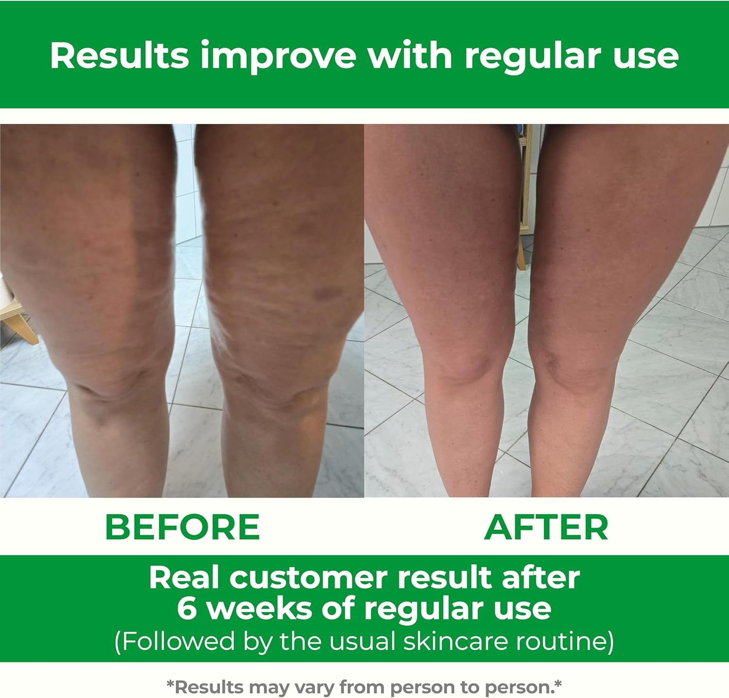 TESMED Cellulite Massager Made in Italy, Patent-Pending Anti-Cellulite Device with Convertible and Divergent Rollers That Lift and Smooth Skin (Pink)