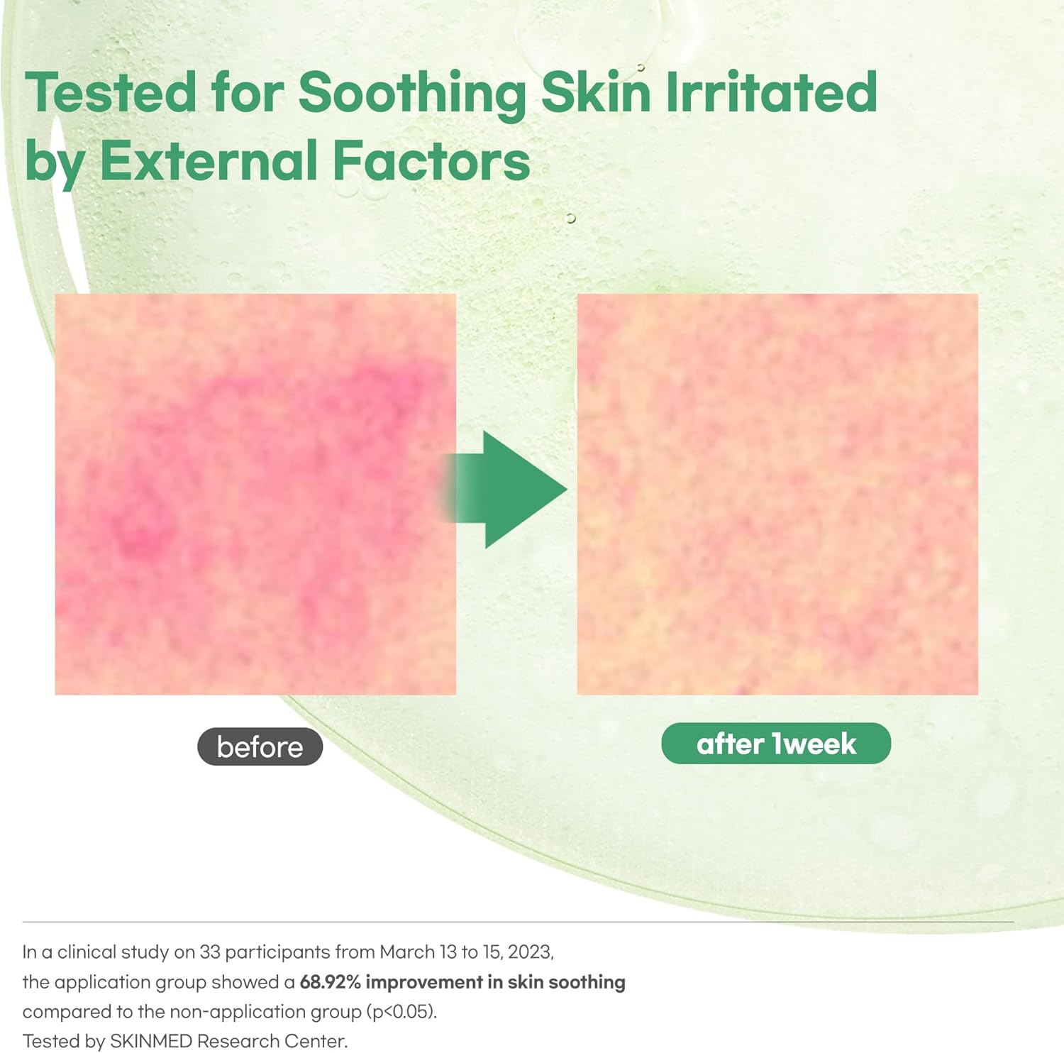 Luvum Calming Repair Cica Oil Serum, Centella Essence, 40% Moisture Oil, 1.01 Fl. Oz image number 4