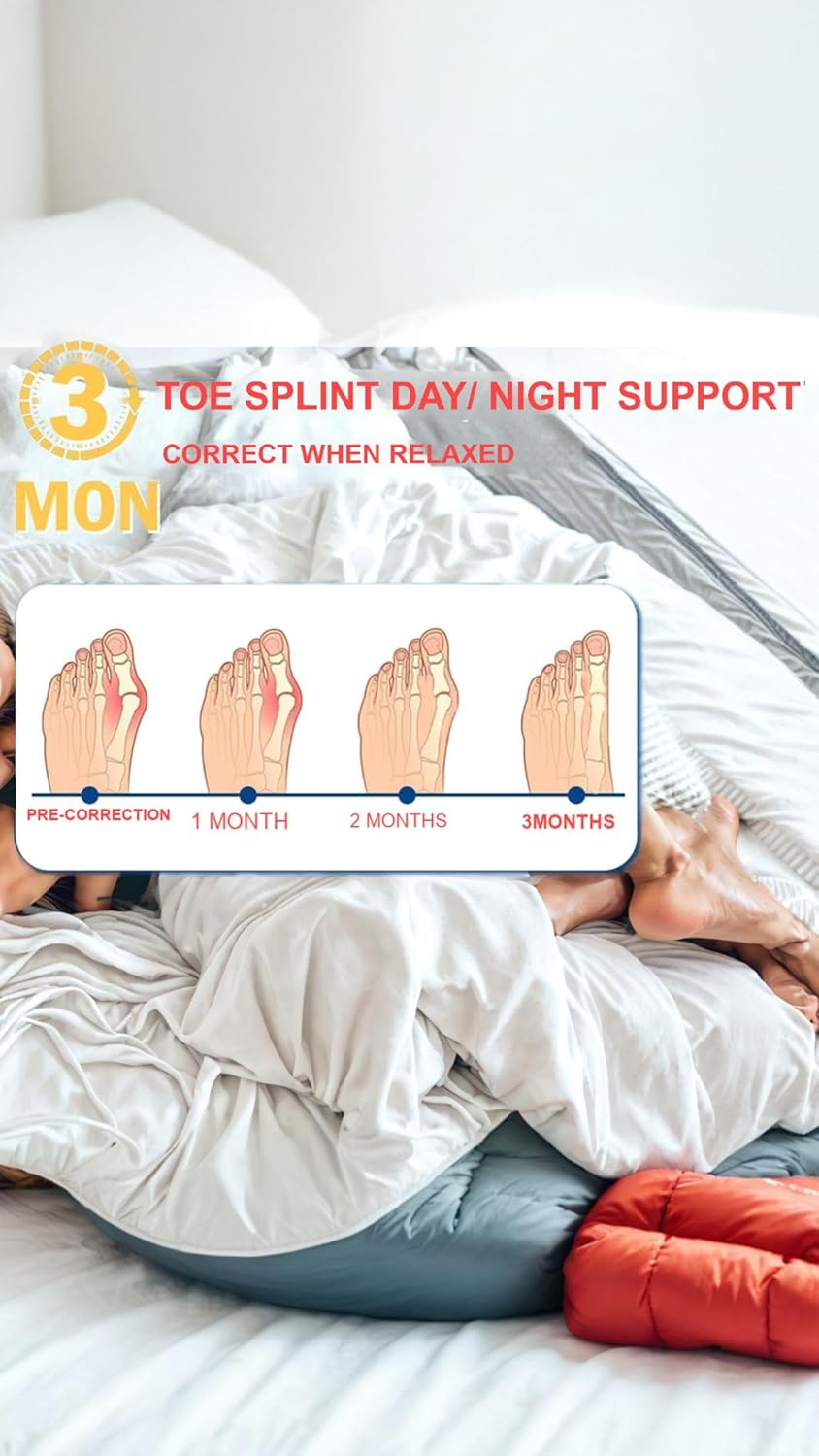 Honwor Bunion Corrector & Toe Straightener - Adjustable Orthopedic Splint for Hallux Valgus & Pain Relief - Fits Both Feet image number 3