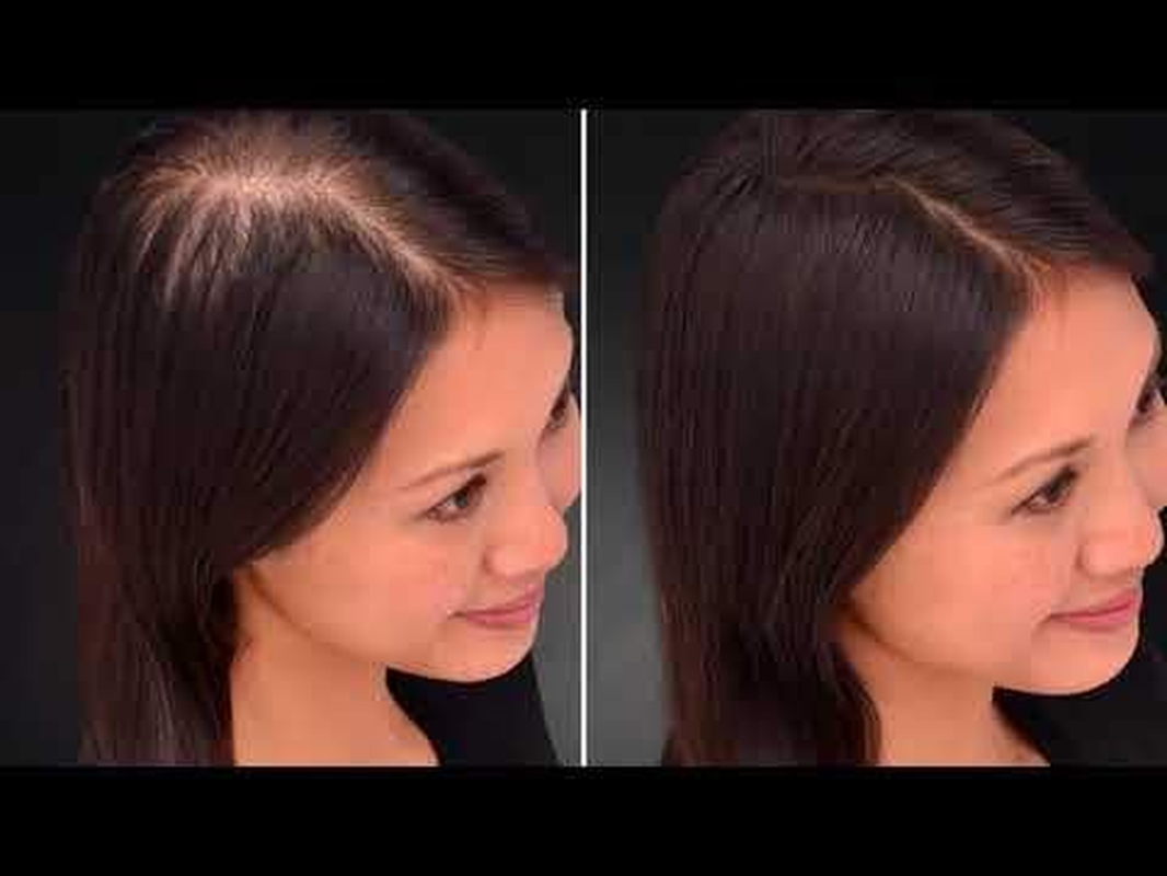 Kabello Hair Building Fiber Refill Pack with Hair Line Comb for Men and Women Fiber 100 Grams Black Pack of 1 image number 3