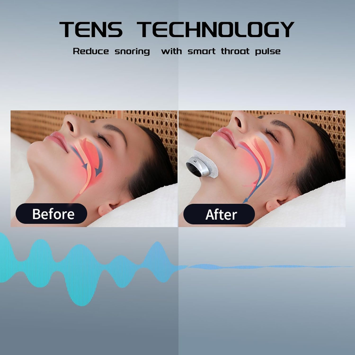 Anti Snoring Devices, anti Snoring Device with Smart Throat Pulse, Electric Sleep Apnea Devices for Best Sleep,Comfortable Snoring Solution for Men and Women, Safe & Effective& Easy image number 2