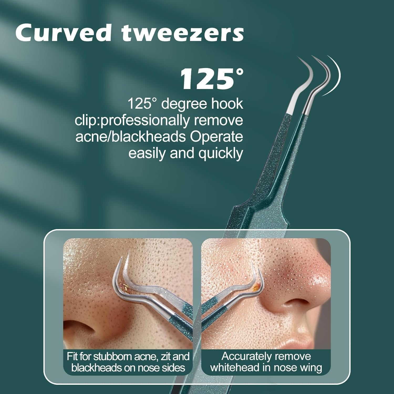 Upgrade Facial Blackhead Remover Tweezers, Ingrown Hair Tweezers,Extractor Acne Removal, Pimple Popper Tool Suit with Box (Green, 3Pieces/1Set) image number 4
