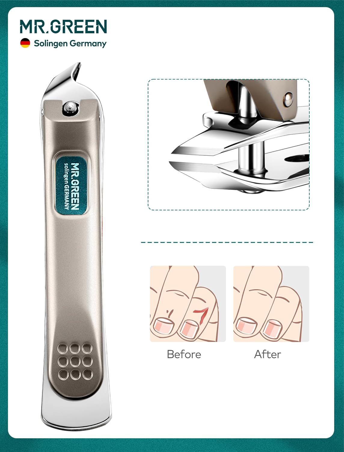 Manicure Pedicure Set, Nail Clippers Set, Medical Grade Stainless Steel Grooming Kit with Travel Case Gift Box (4 Pieces) image number 1