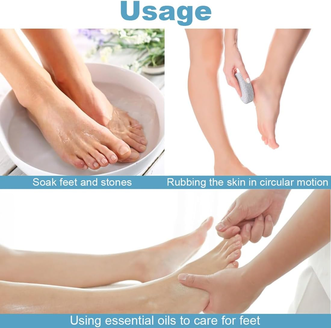 Pumice Stone Foot Care Pack of 4, Pumice Stone Callus Remover for Feet and Hands, Foot Scrub for Perfect Callus and Skin Hardening Removal, Natural Foot Scrub for Dead
