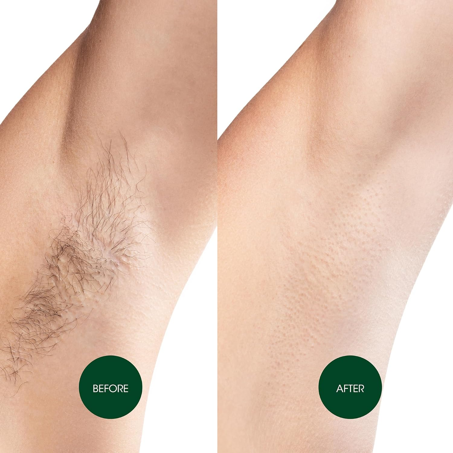 Nad'S Hair Removal Body Wax Strips for Normal Skin, Body Hair Removal, Pack of 20