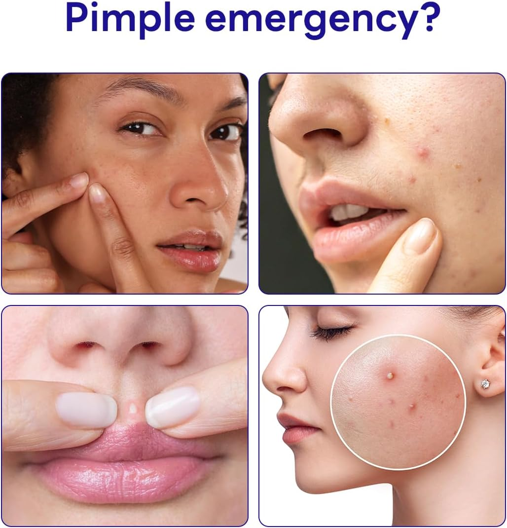 MEDIHEAL Derma Clear Teatree Treatment Spot Patch (44 Counts) - Acne Relief, Oil and Moisture Balance with Teatree & Salicylic Acid image number 6