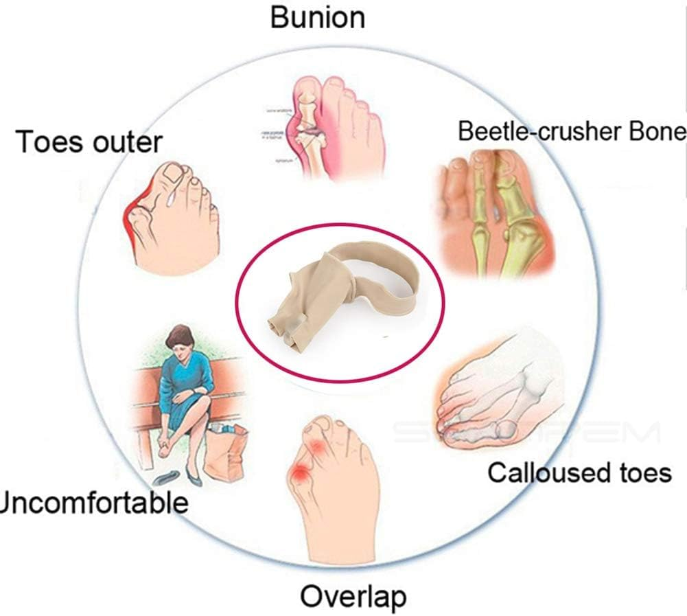 Bunion Straightener Protector Relief Sleeve W/Gel Bunion Stretchy Pads Cushioned Splint, Bunion Cushions,Orthopedic Hallux Valgus Overlapping Corrector Bootie Guard Hammer Toe Pain Aid Surgery Treatment 2 Pcs image number 2